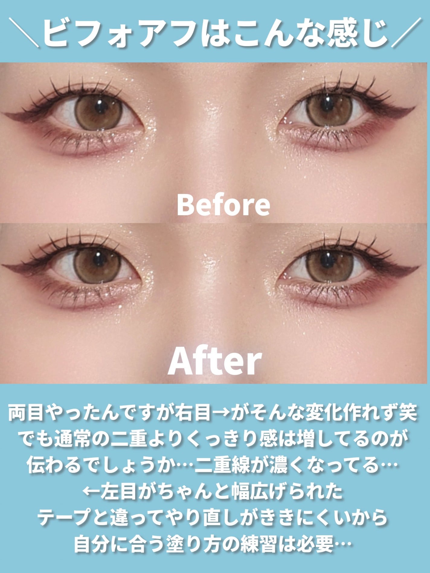 オリシキ アイリッドスキンフィルム EX/D-UP/二重まぶた用アイテムを使ったクチコミ(8枚目)