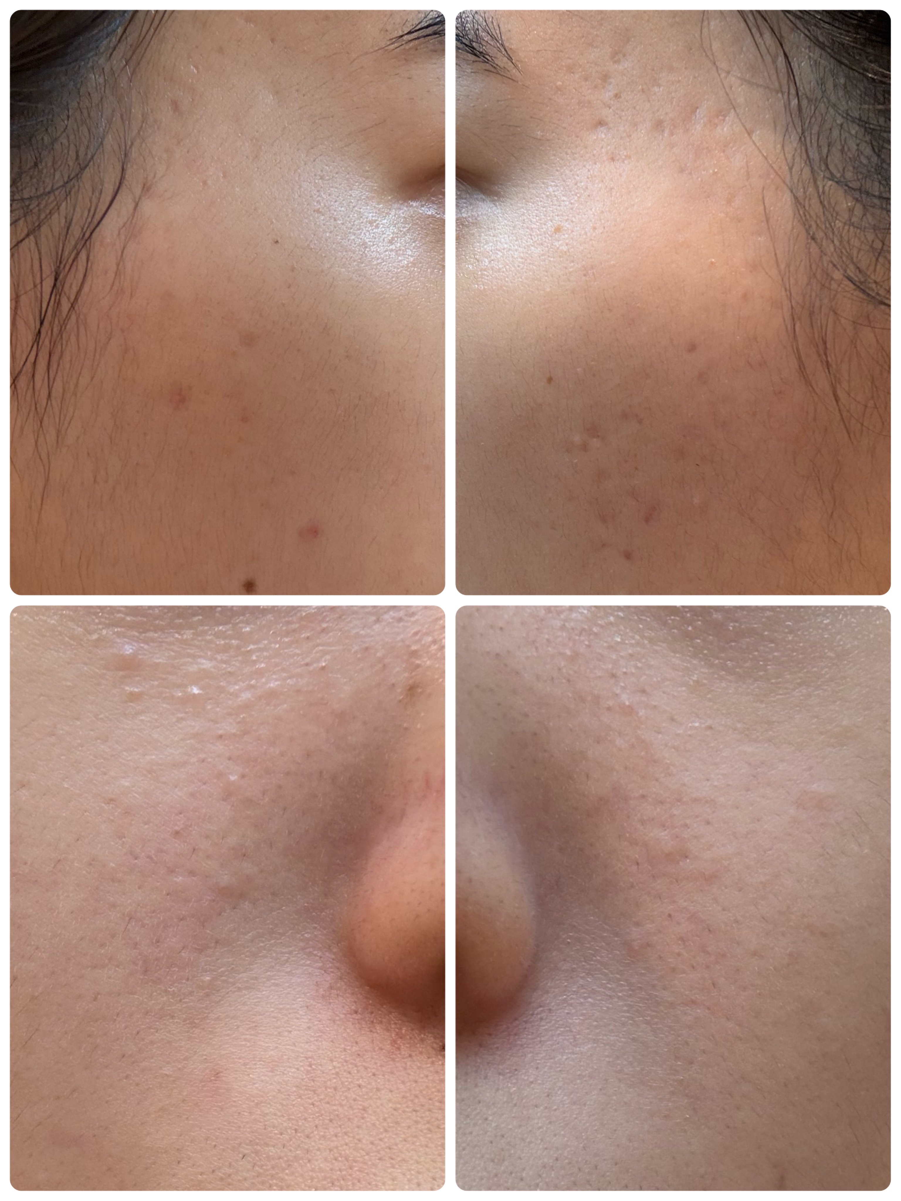 GLAM UP炭酸泡クレイマスク/GLAM UP/洗い流すパック・マスクを使ったクチコミ（2枚目）