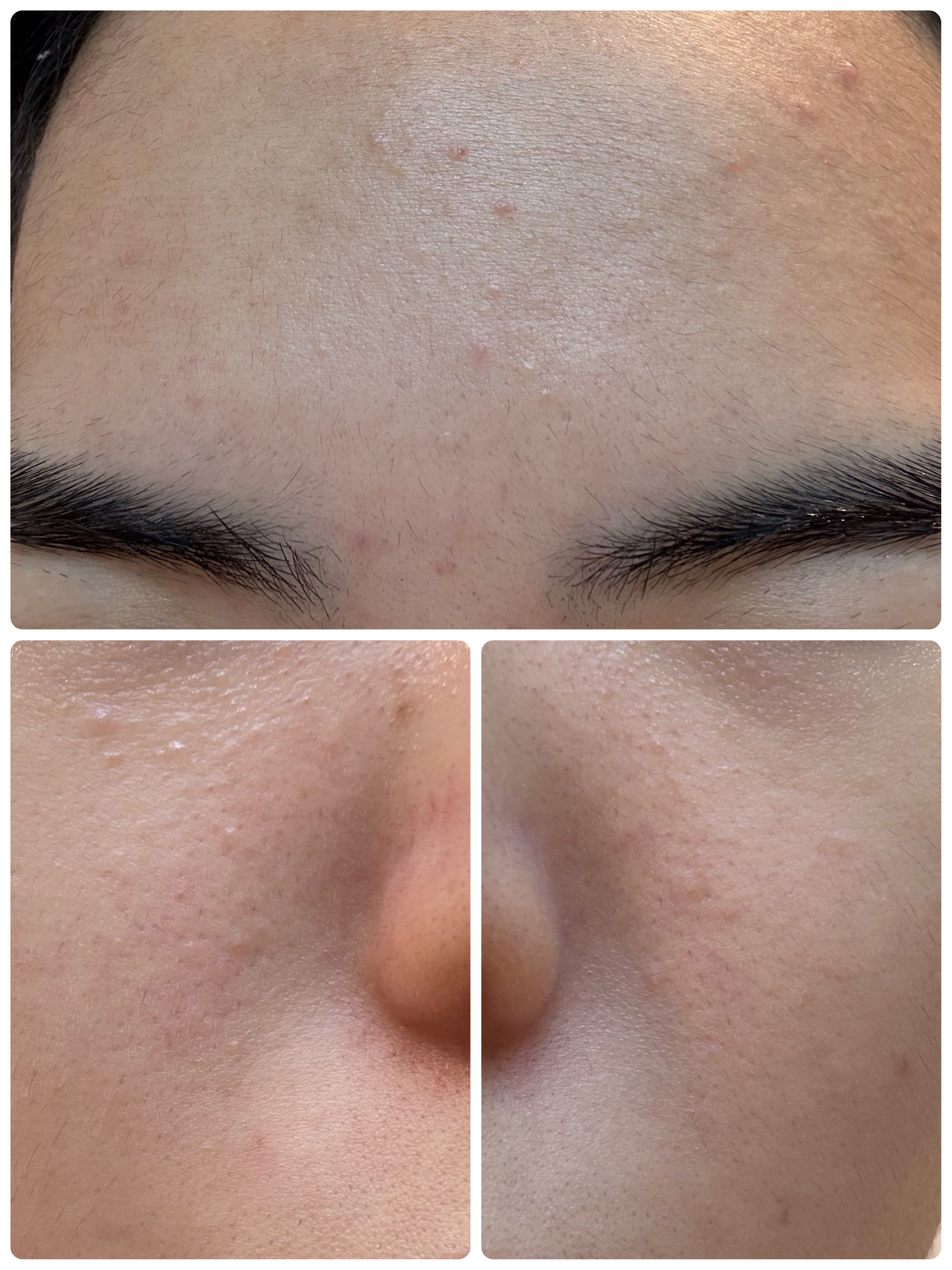 GLAM UP炭酸泡クレイマスク/GLAM UP/洗い流すパック・マスクを使ったクチコミ（3枚目）