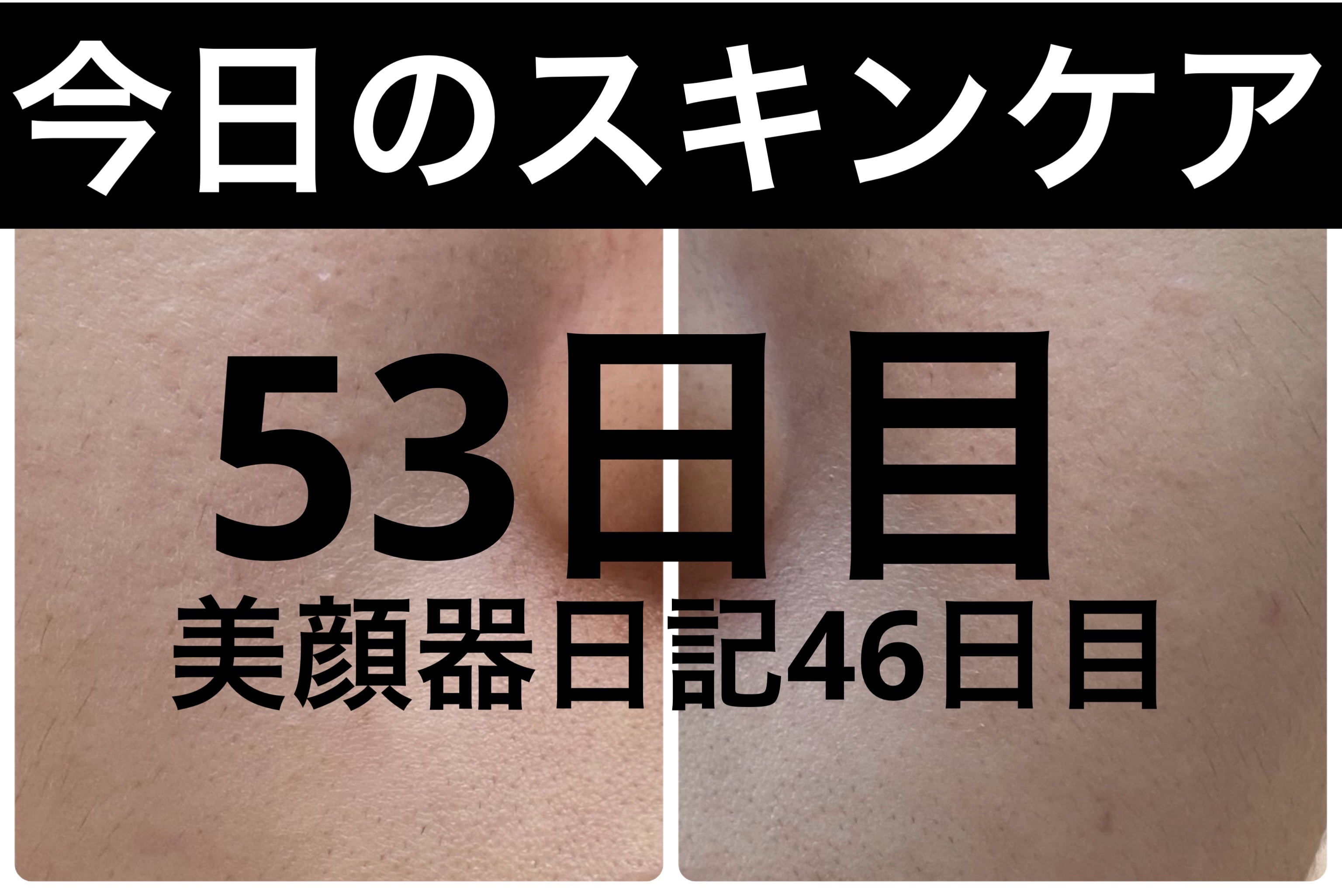 GLAM UP炭酸泡クレイマスク/GLAM UP/洗い流すパック・マスクを使ったクチコミ（1枚目）