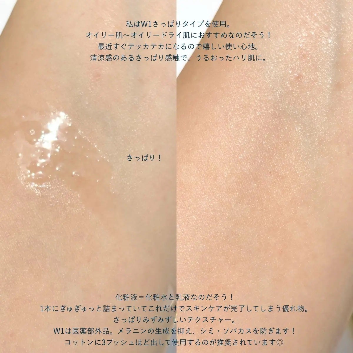 スキンメインテナイザー ST W1/リサージ/化粧水を使ったクチコミ(3枚目)