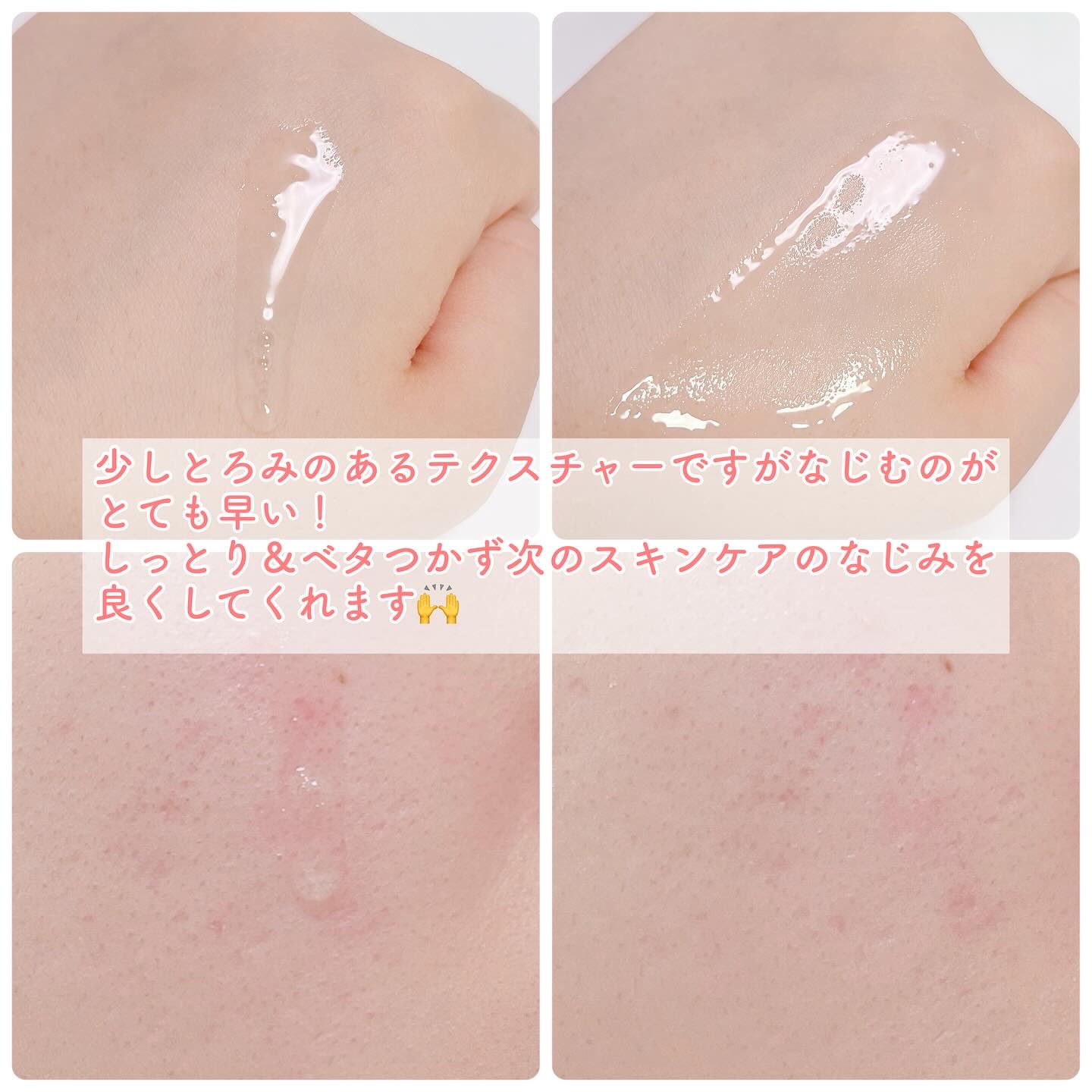 スネイルソリューション スキンブースター(R)/ネイチャーリパブリック/ブースター・導入液を使ったクチコミ（3枚目）