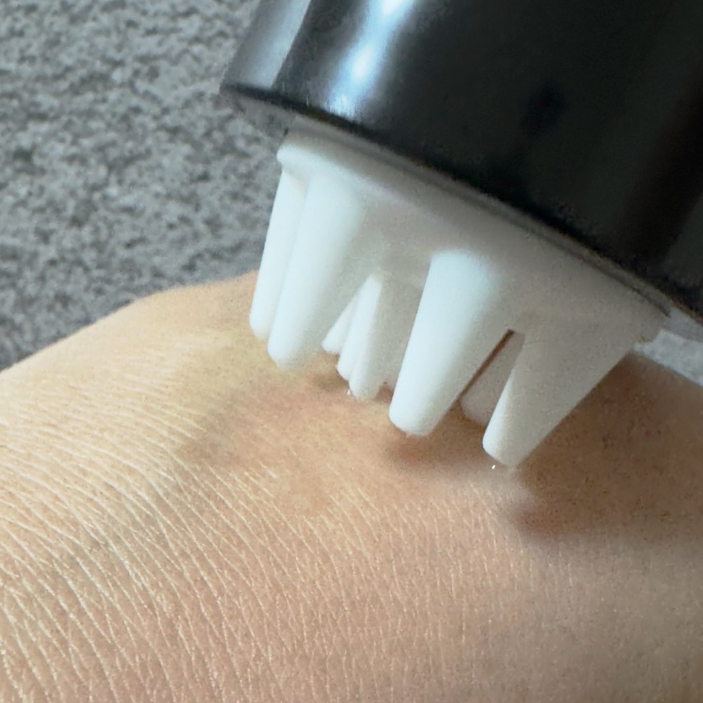 サイトカイン ブースター/Refilled/頭皮ローションを使ったクチコミ(4枚目)