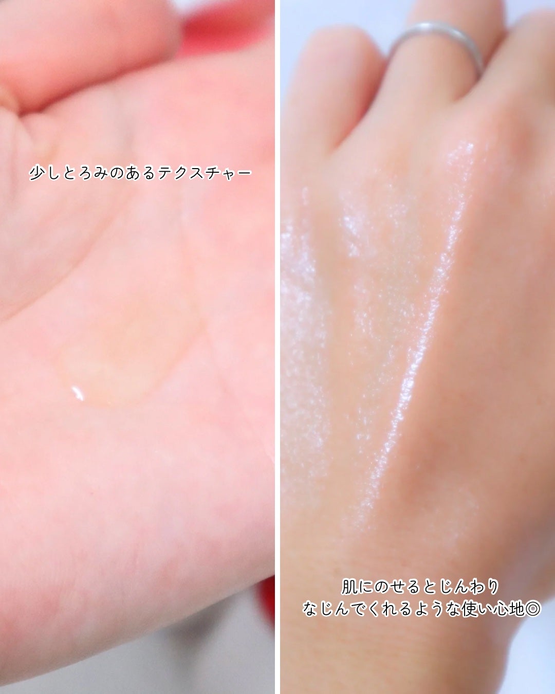 アルブラン ザ ローション III /ALBLANC/化粧水を使ったクチコミ(4枚目)