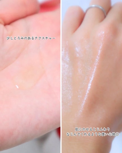 アルブラン ザ ローション III /ALBLANC/化粧水を使ったクチコミ(4枚目)