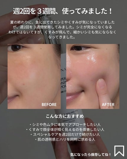 アットクリニック ハイパーPトーニング美容液/DOMINAS/美容液を使ったクチコミ(5枚目)