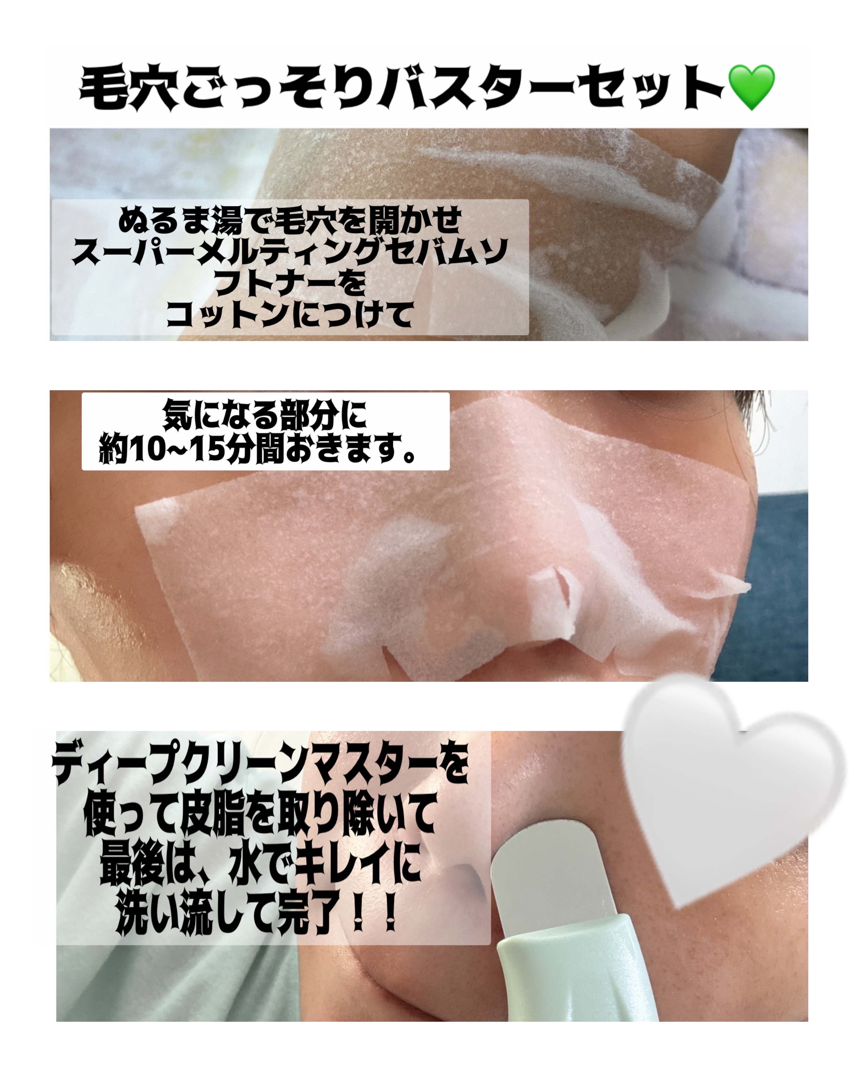 ナチュラルマイルドクリアノーズパック/ilso/シートマスク・パックを使ったクチコミ（2枚目）