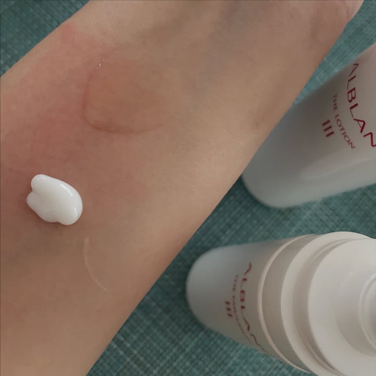 アルブラン ザ ローション III /ALBLANC/化粧水を使ったクチコミ(5枚目)