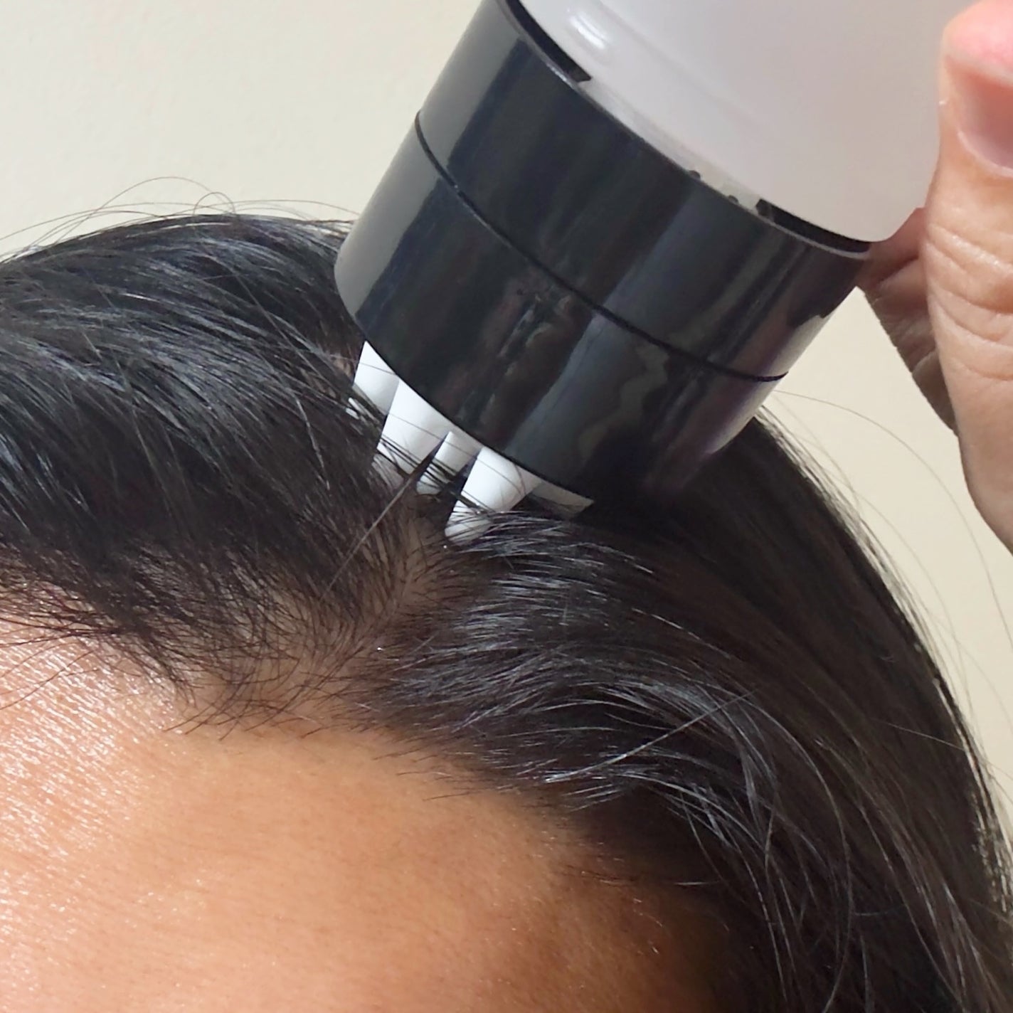 サイトカイン ブースター/Refilled/頭皮ローションを使ったクチコミ(5枚目)