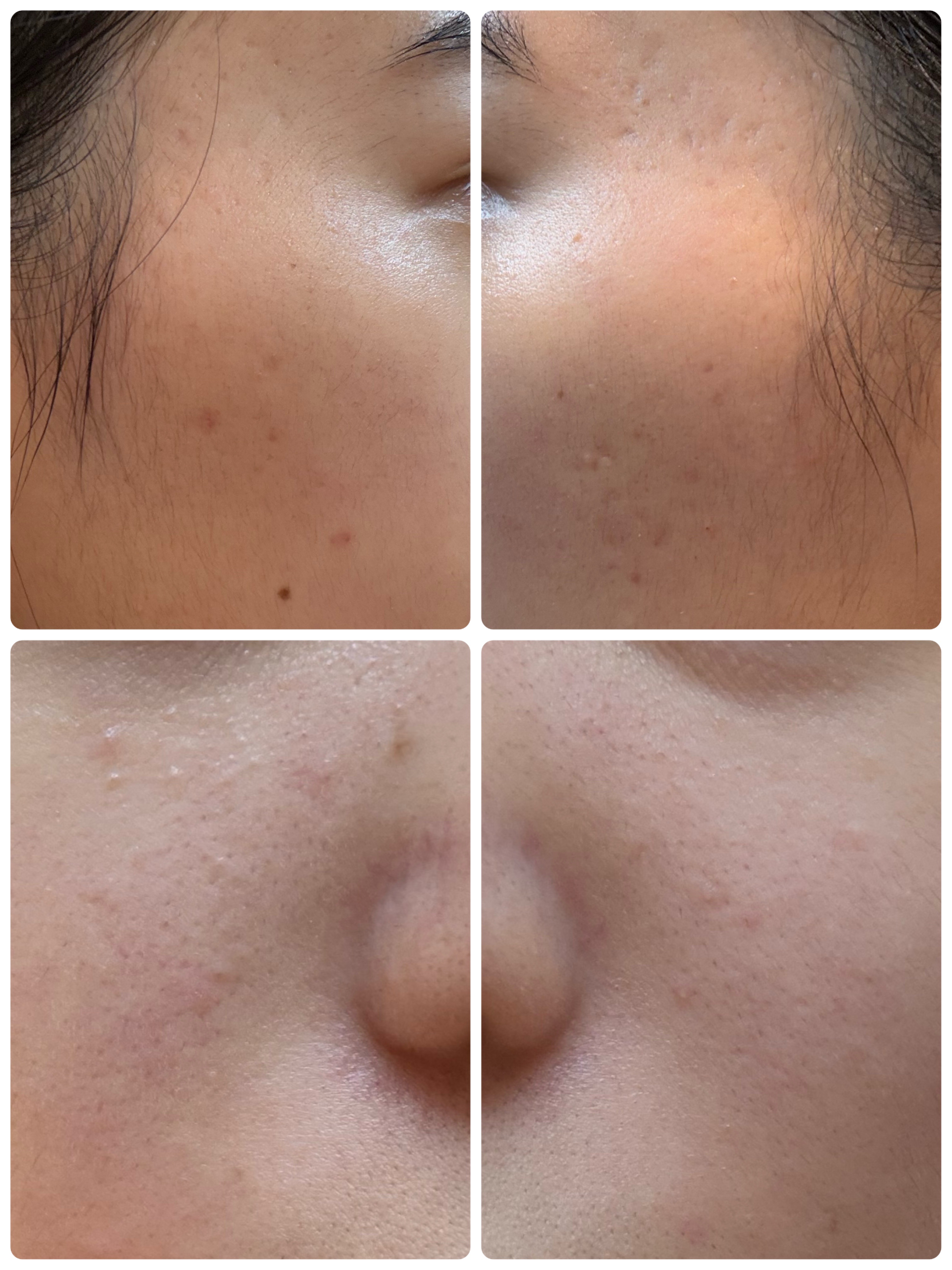 モーニングジェルウォッシュ/ビトレスキン/その他洗顔料を使ったクチコミ（2枚目）