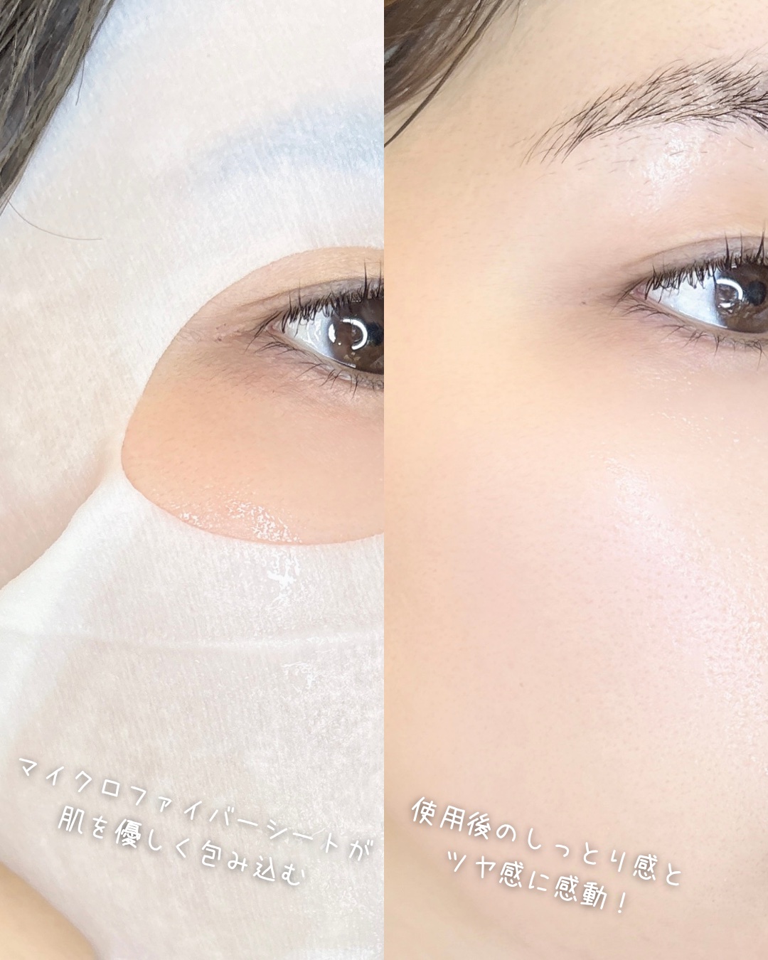 REJURAN ターンオーバーマスク(5枚入り)/REJURAN COSMETICS/シートマスク・パックを使ったクチコミ（3枚目）