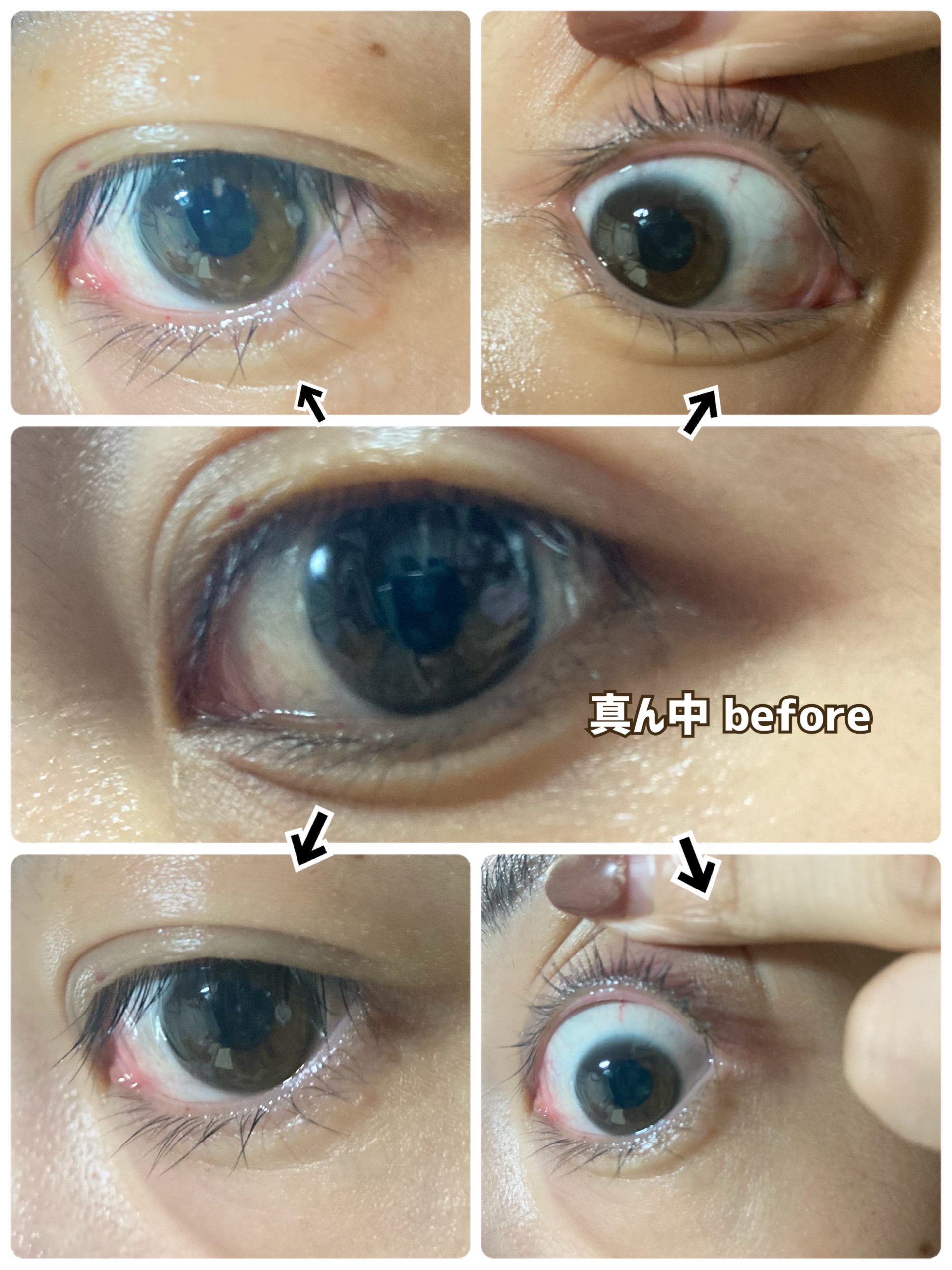 アイラッシュエッセンシャルセラム/epais/まつげ美容液を使ったクチコミ（3枚目）