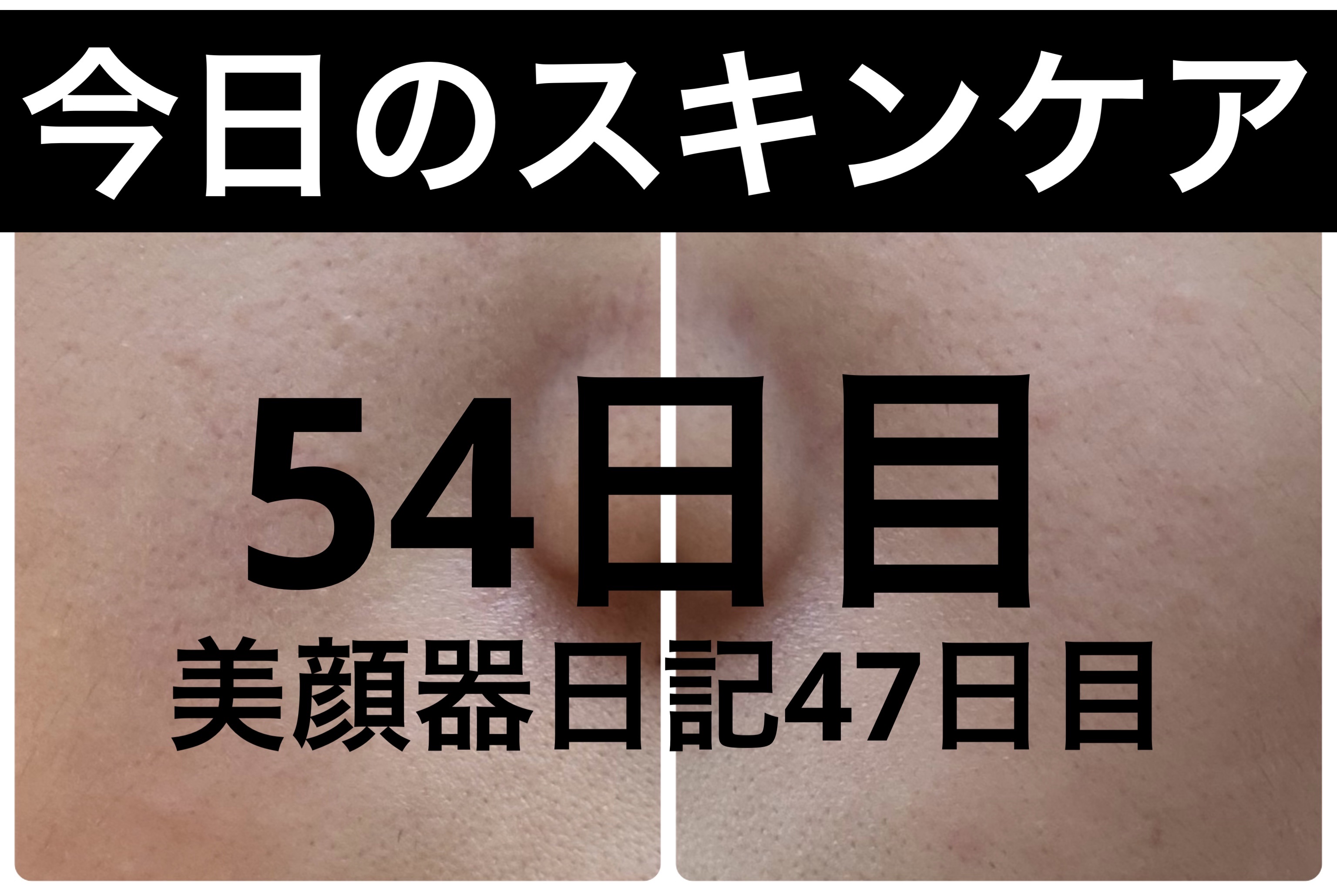 モーニングジェルウォッシュ/ビトレスキン/その他洗顔料を使ったクチコミ（1枚目）