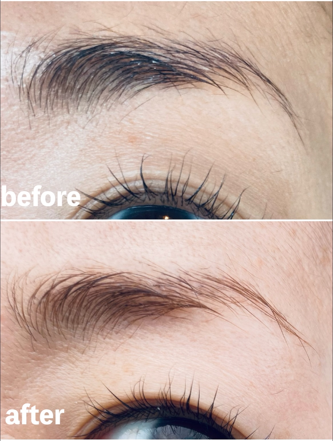 脱色クリーム 敏感肌用/エピラット/ムダ毛ケアを使ったクチコミ（2枚目）