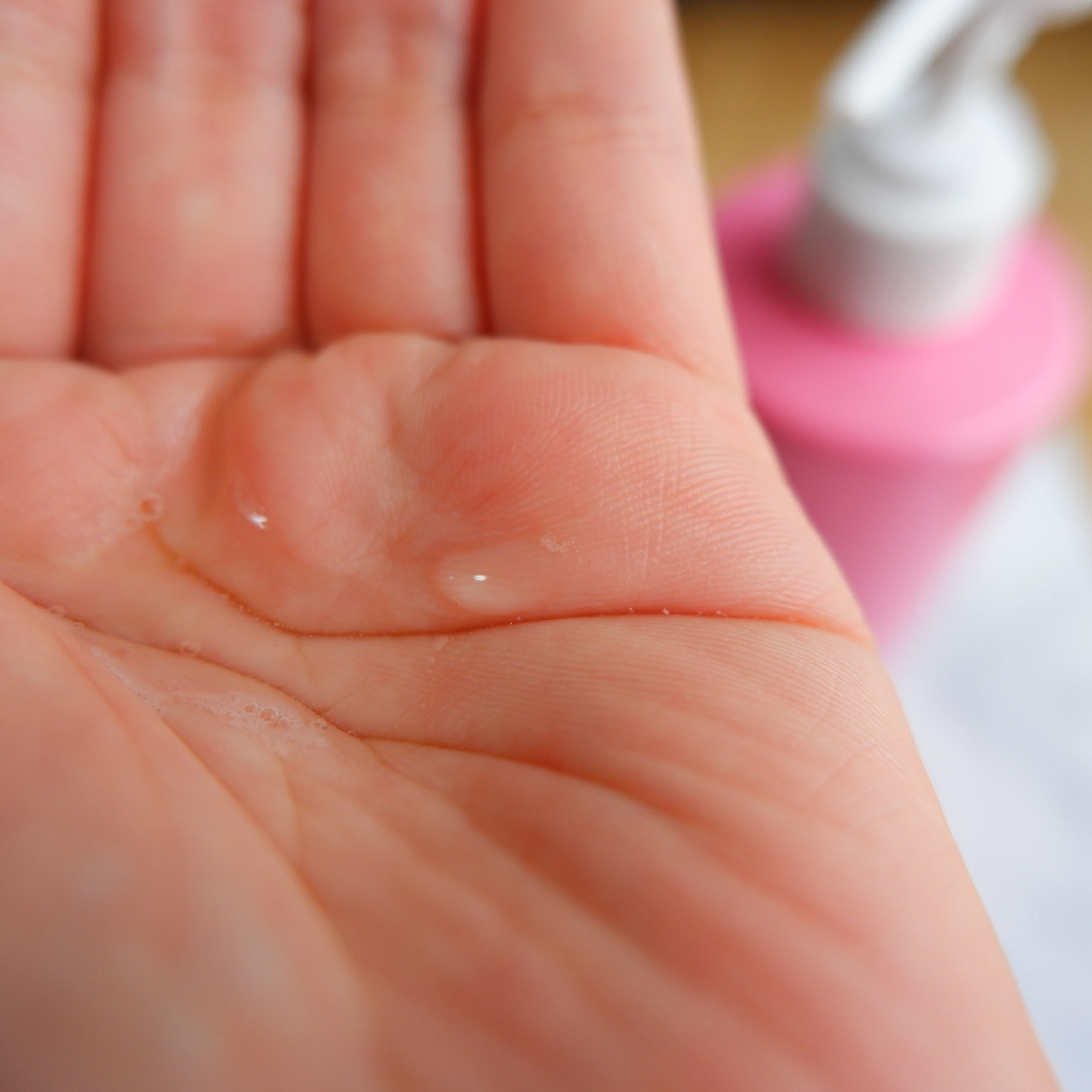 ヘパトリート 薬用保湿化粧水　[医薬部外品]/ゼトックスタイル/化粧水を使ったクチコミ（2枚目）