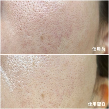 NMN-PDRN ダーマアンサー ポア ファーミング アンプル/CNP Laboratory/美容液を使ったクチコミ(3枚目)