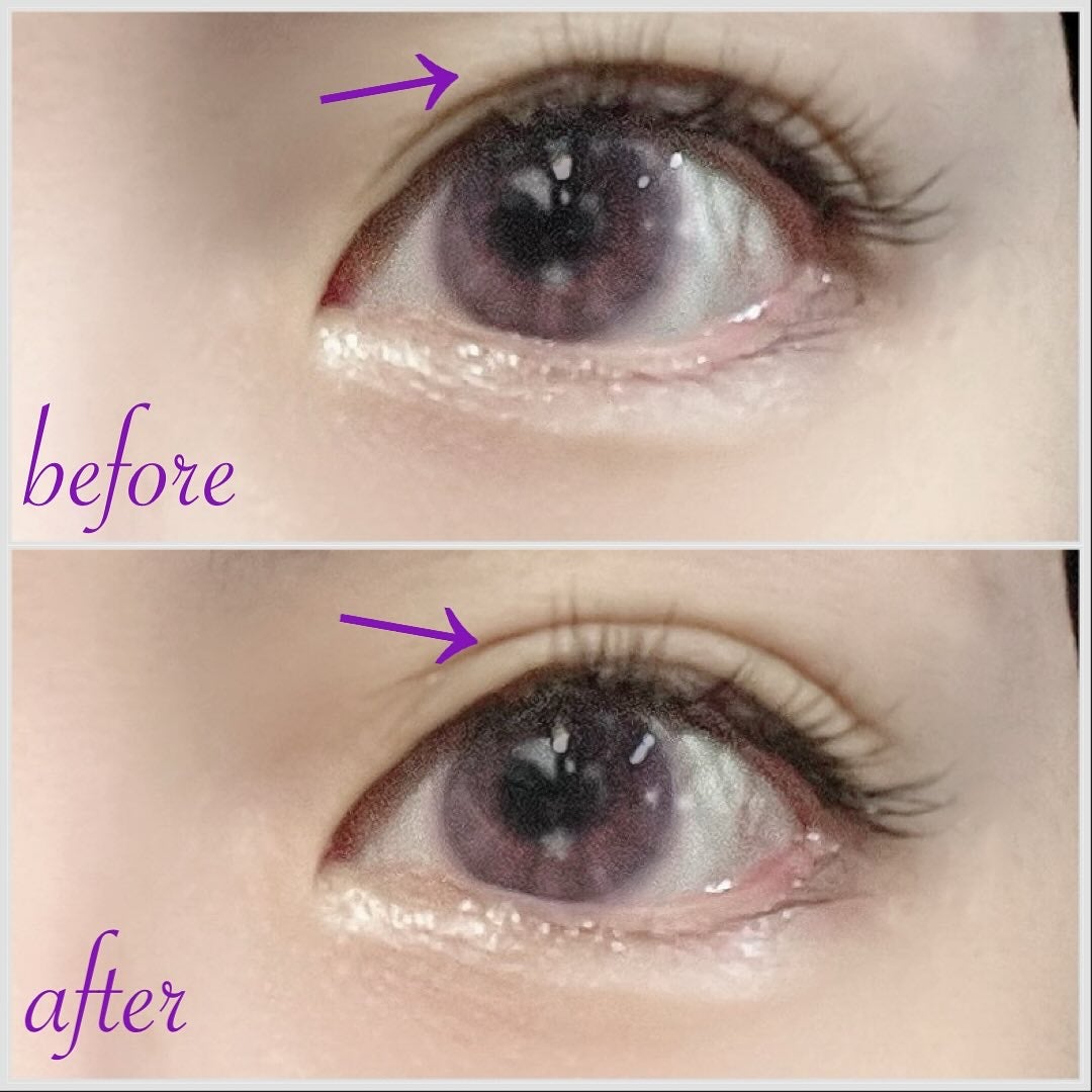 Eye kutto/メザイク/二重まぶた用アイテムを使ったクチコミ(5枚目)