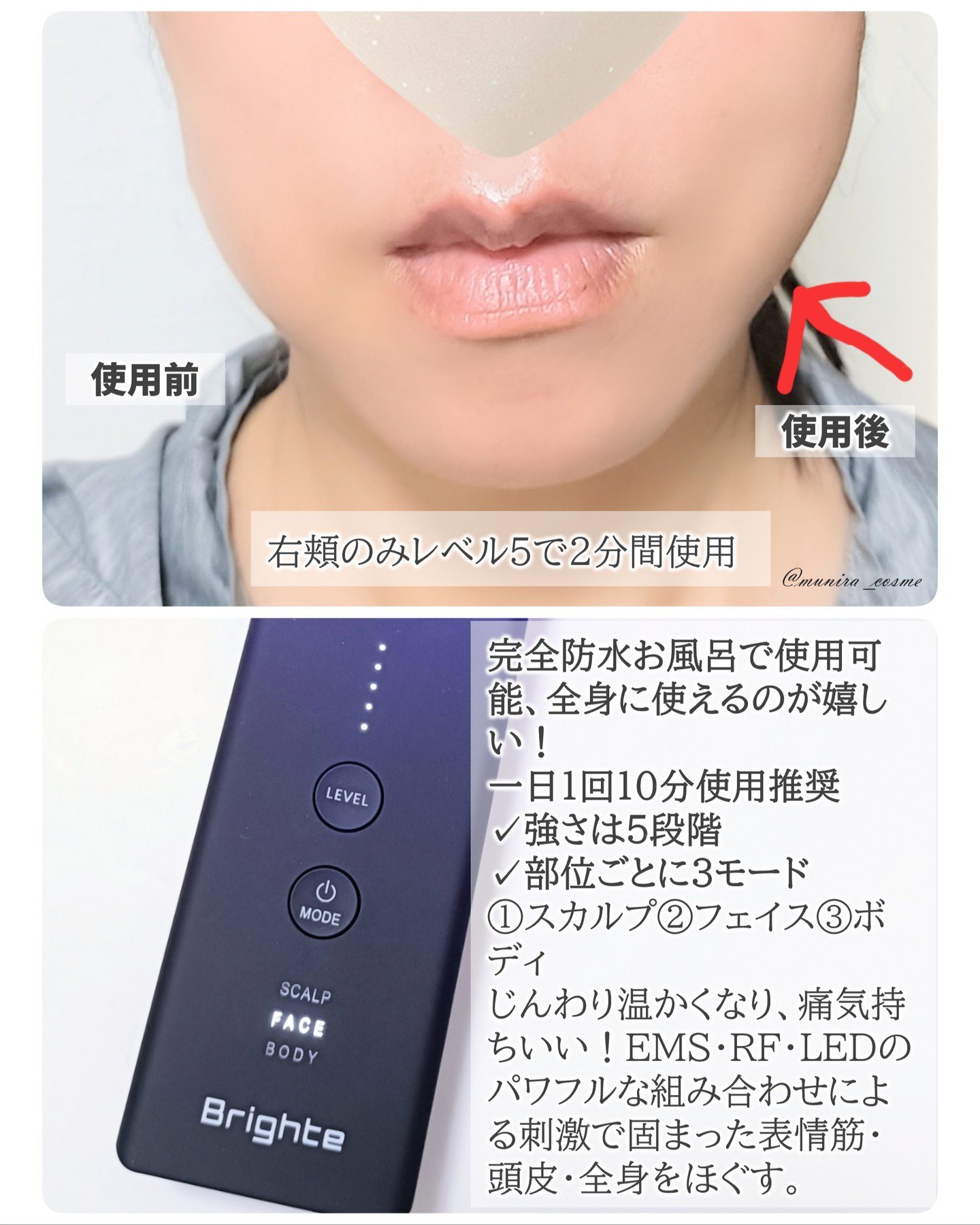 ELEKI BRUSH＋/Brighte/美顔器・マッサージを使ったクチコミ（2枚目）