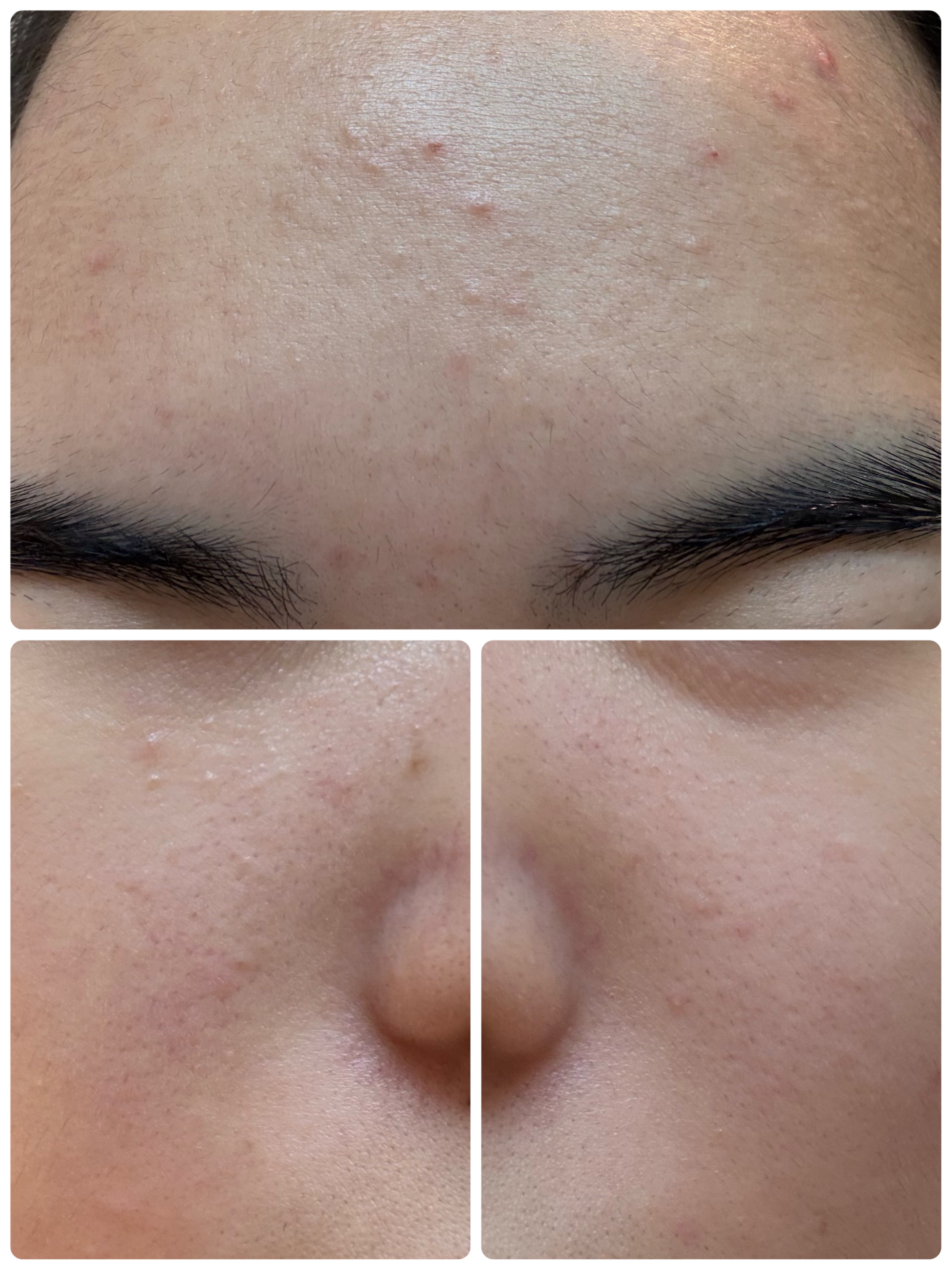 モーニングジェルウォッシュ/ビトレスキン/その他洗顔料を使ったクチコミ（3枚目）