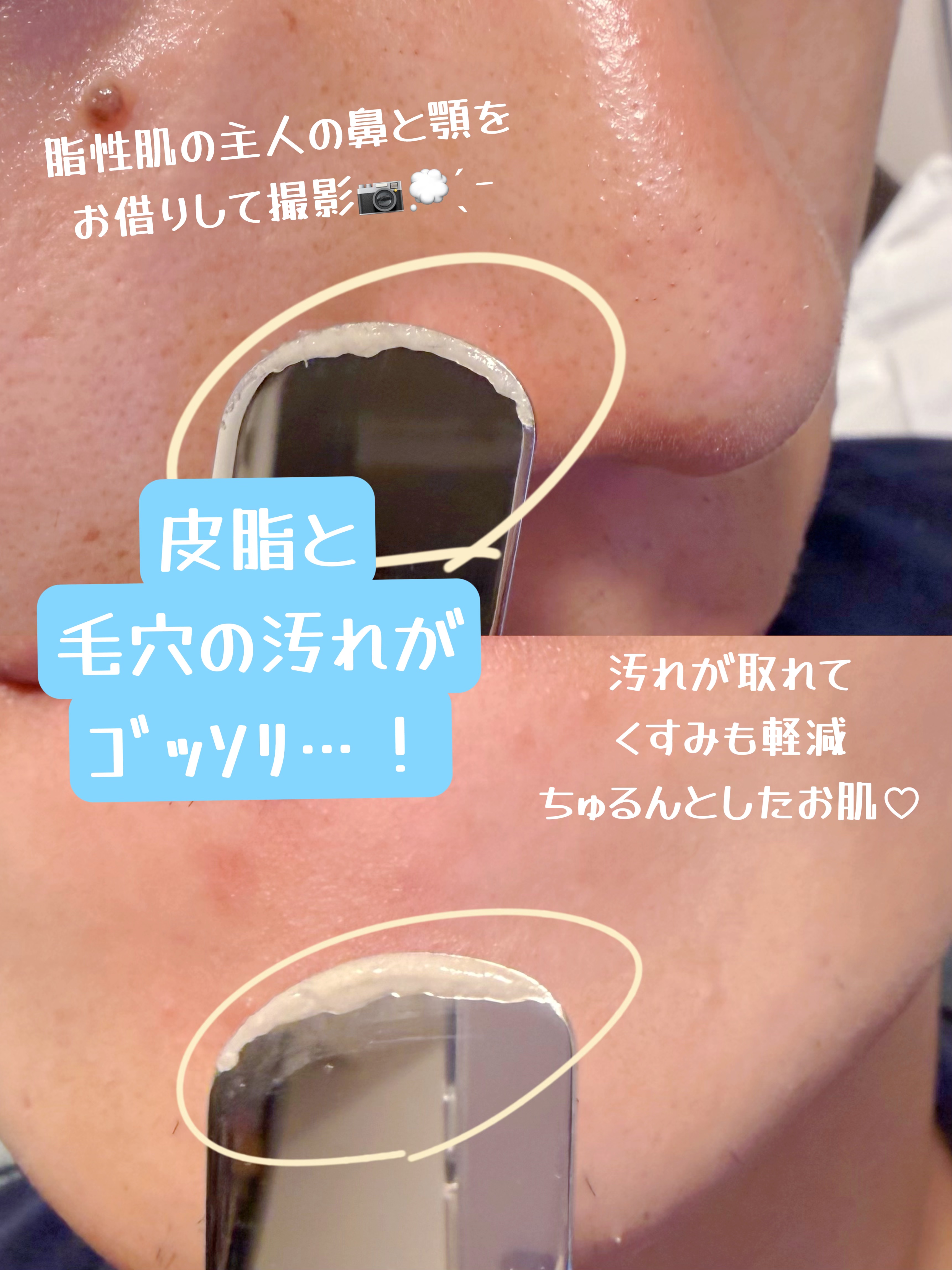 ディープクリーンマスター/ilso/その他スキンケアグッズを使ったクチコミ（2枚目）