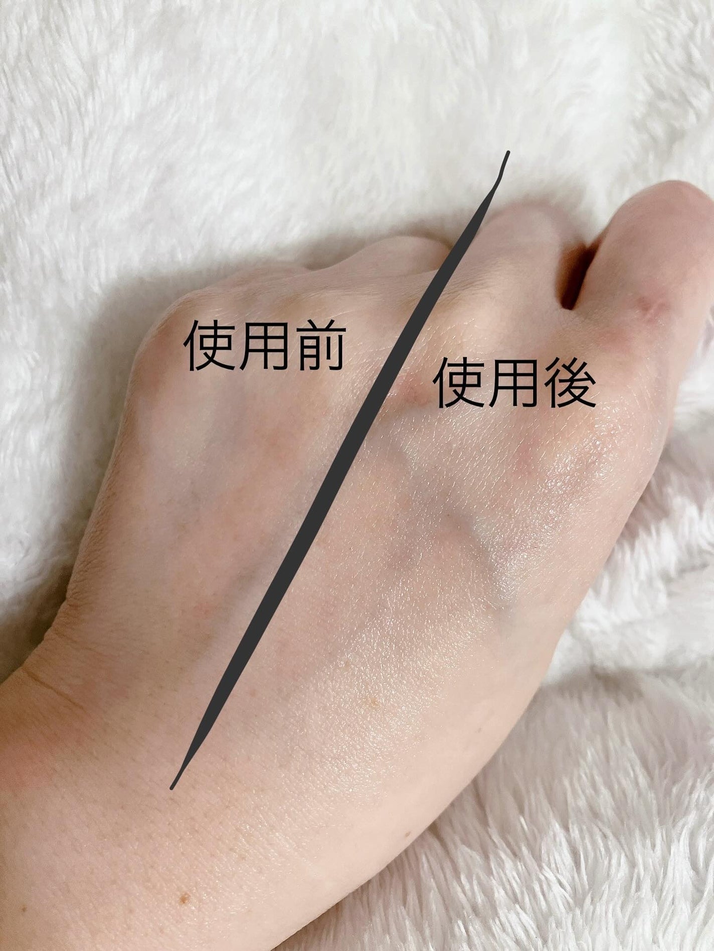 360度ショットPDRNアクティブセラム/センテリアン24/美容液を使ったクチコミ(3枚目)