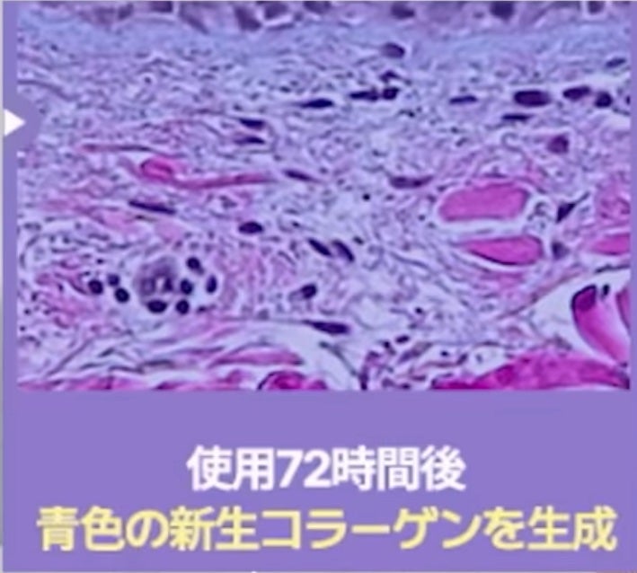 360度ショットPDRNアクティブセラム/センテリアン24/美容液を使ったクチコミ(3枚目)