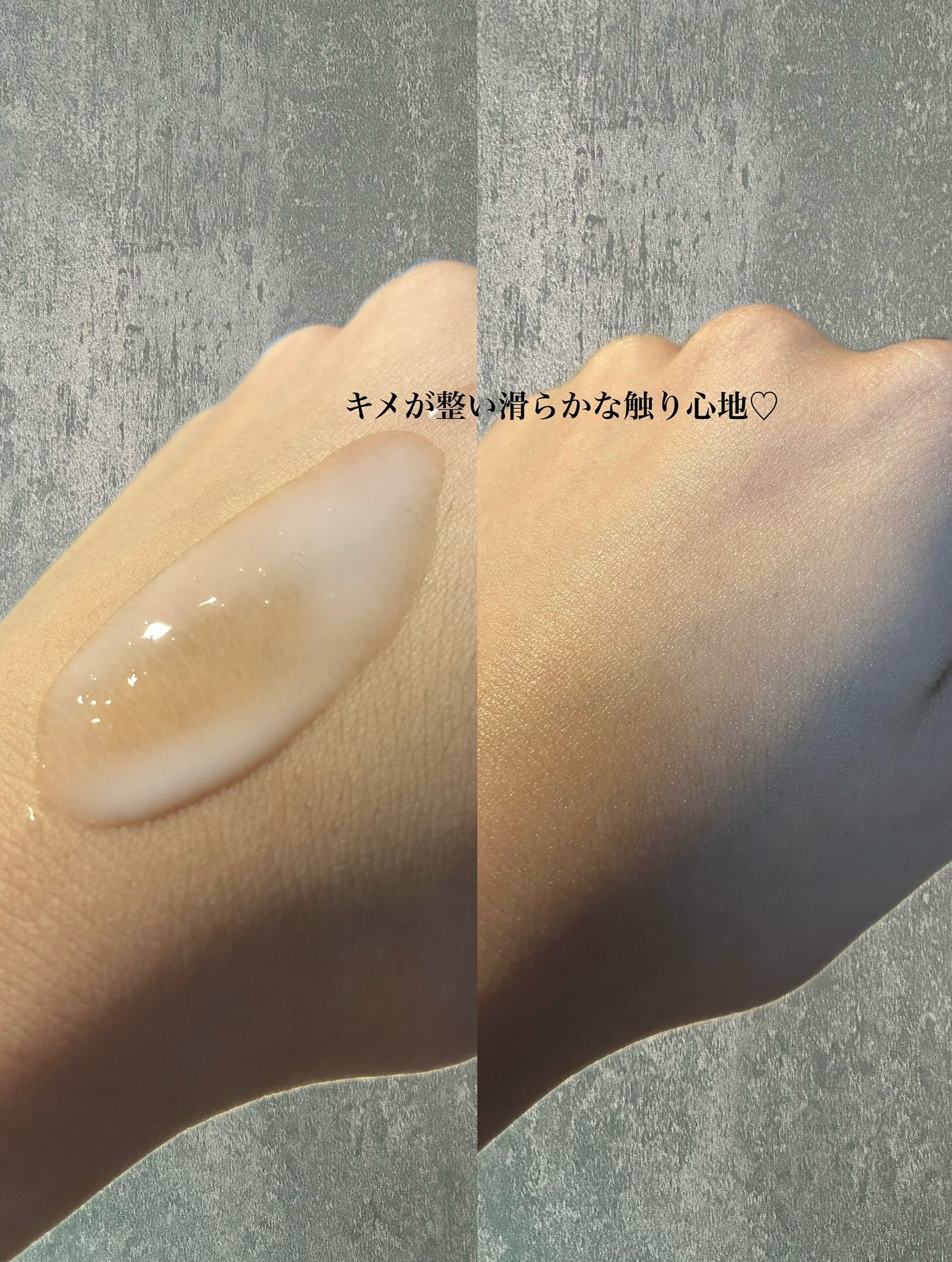 ダーマアンサーPDRNトナー/CNP Laboratory/化粧水を使ったクチコミ(3枚目)