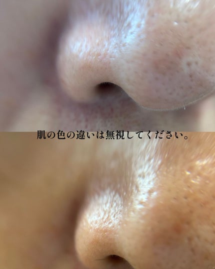 ritan on LIPS ãð¿è¥èœãã¢ã¿ã€ããã³ã°ã»ã©ã ïŒSuiskinïŒã¹ã€ã¹ãã³ïŒæ¯ç©Ž..ãïŒ9æç®ïŒ