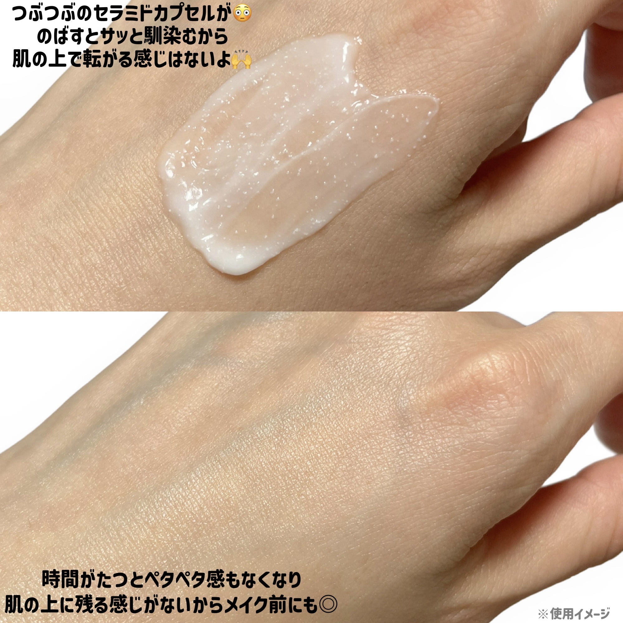 アトバリア365クリーム/AESTURA/フェイスクリームを使ったクチコミ（3枚目）