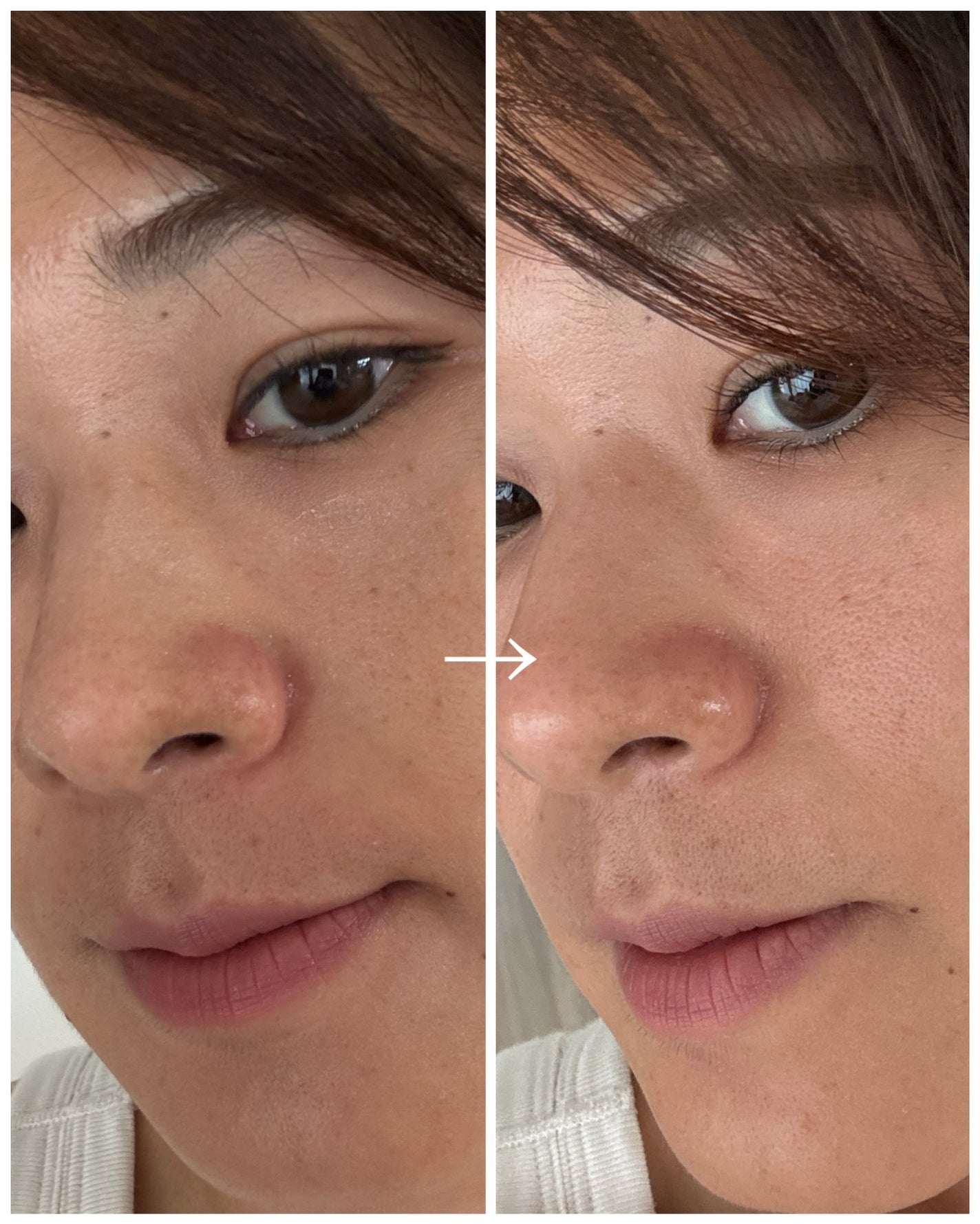 ナチュラルマイルドクリアノーズパック/ilso/シートマスク・パックを使ったクチコミ(4枚目)