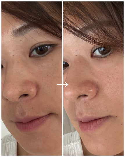 ナチュラルマイルドクリアノーズパック/ilso/シートマスク・パックを使ったクチコミ(4枚目)