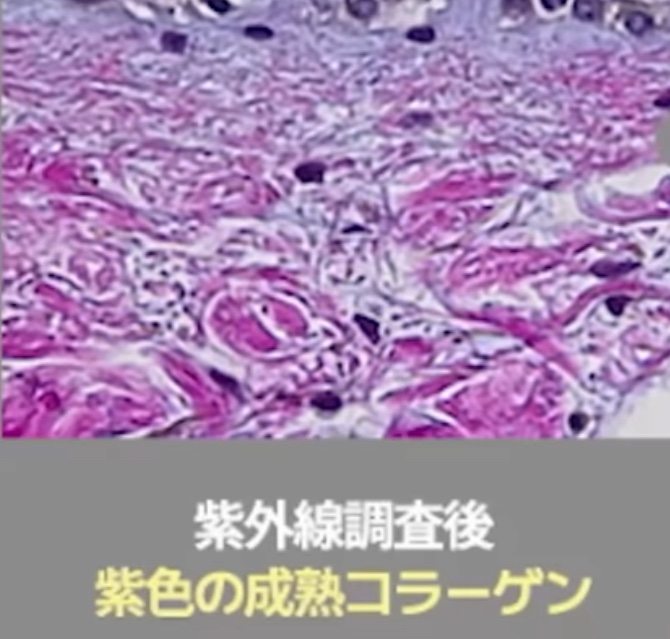 360度ショットPDRNアクティブセラム/センテリアン24/美容液を使ったクチコミ（2枚目）