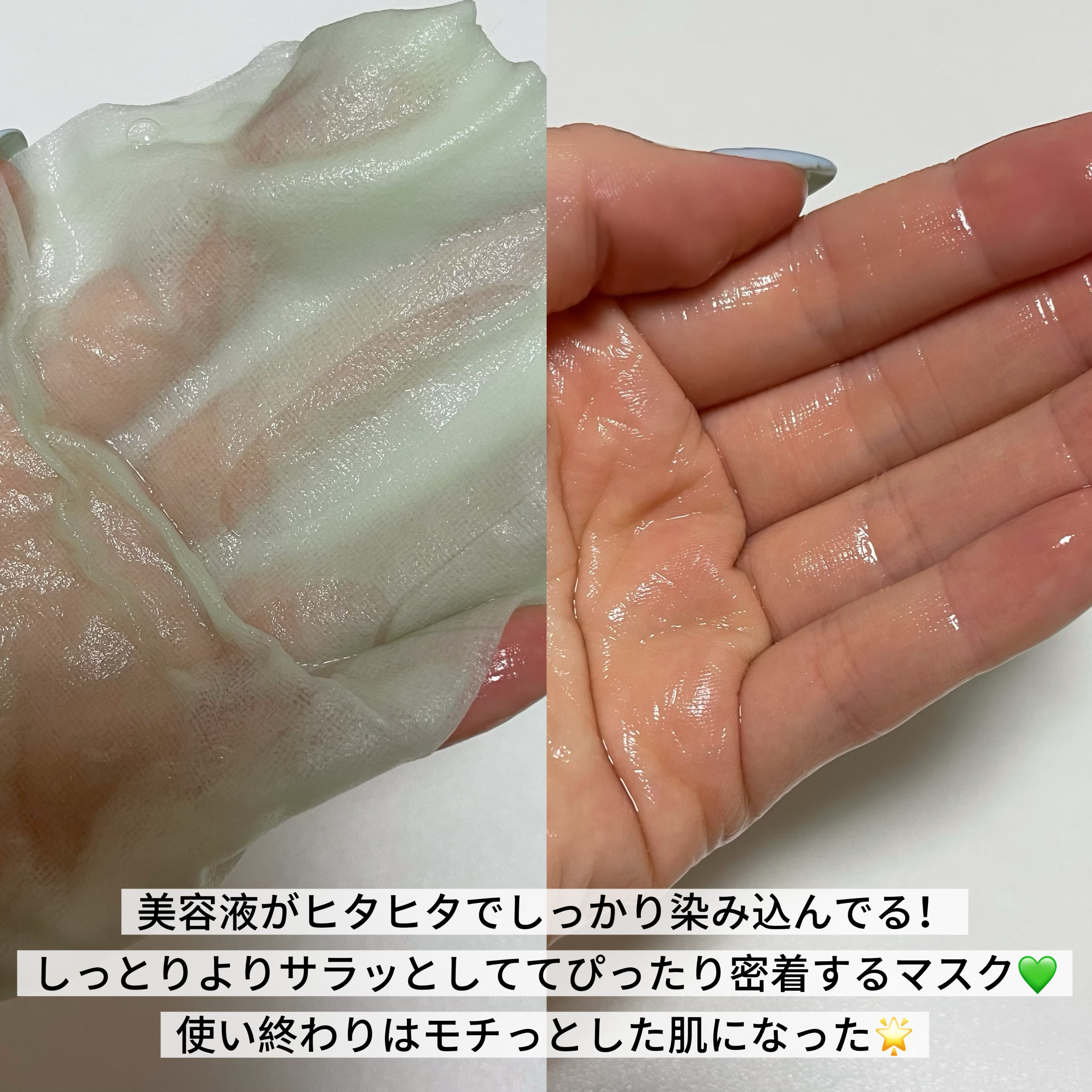 アゼライン酸15 インテンスカーミングセラムインマスク/Anua/シートマスク・パックを使ったクチコミ（2枚目）