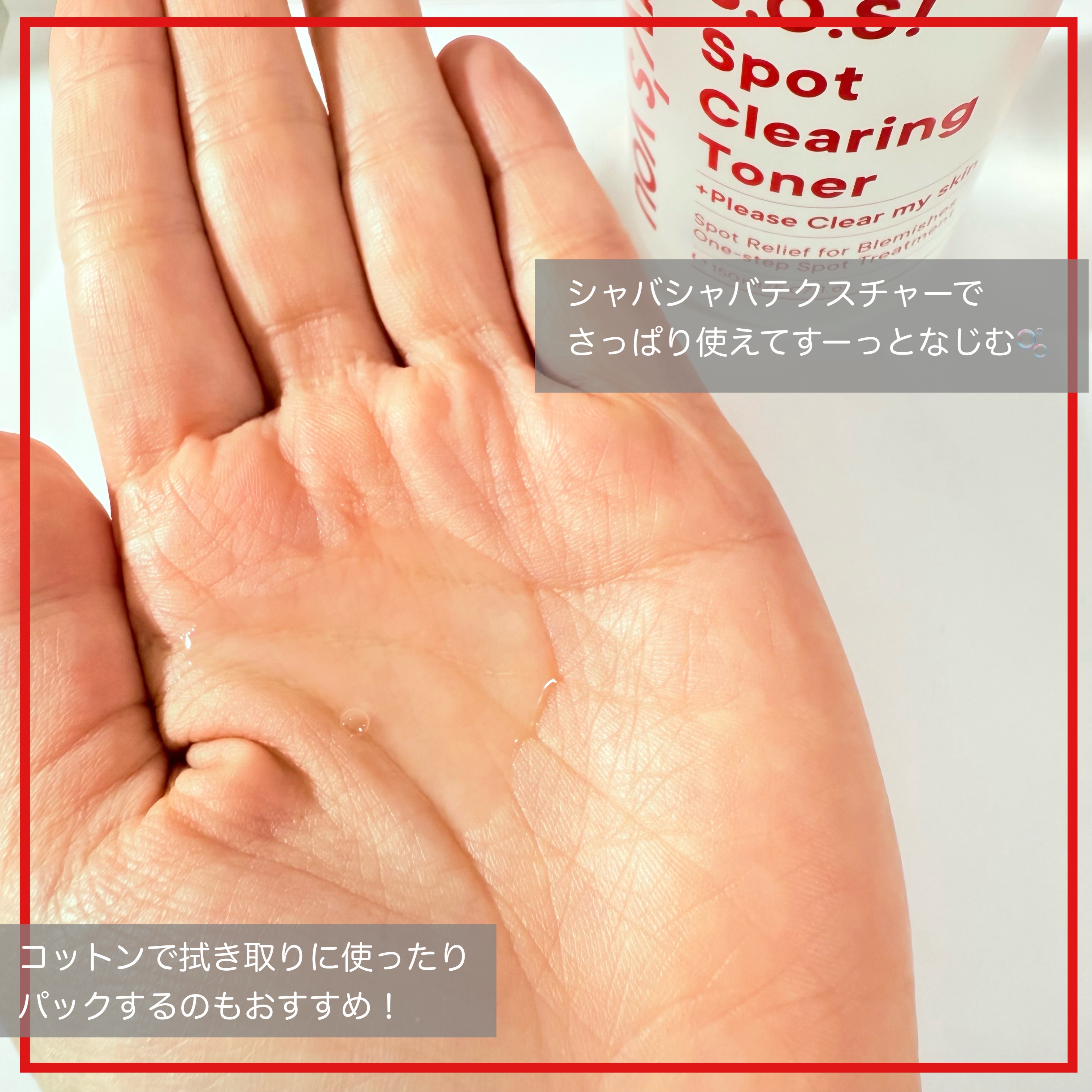 SOSスポットクリアトナー/One-day&#39;s you/化粧水を使ったクチコミ（3枚目）