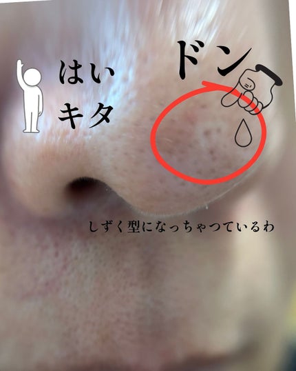 ritan on LIPS ãð¿è¥èœãã¢ã¿ã€ããã³ã°ã»ã©ã ïŒSuiskinïŒã¹ã€ã¹ãã³ïŒæ¯ç©Ž..ãïŒ7æç®ïŒ