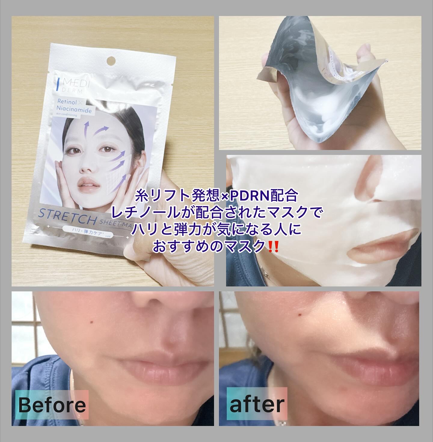 メディダ―マ ストレッチシートマスク/メディダーマ/シートマスク・パックを使ったクチコミ（2枚目）