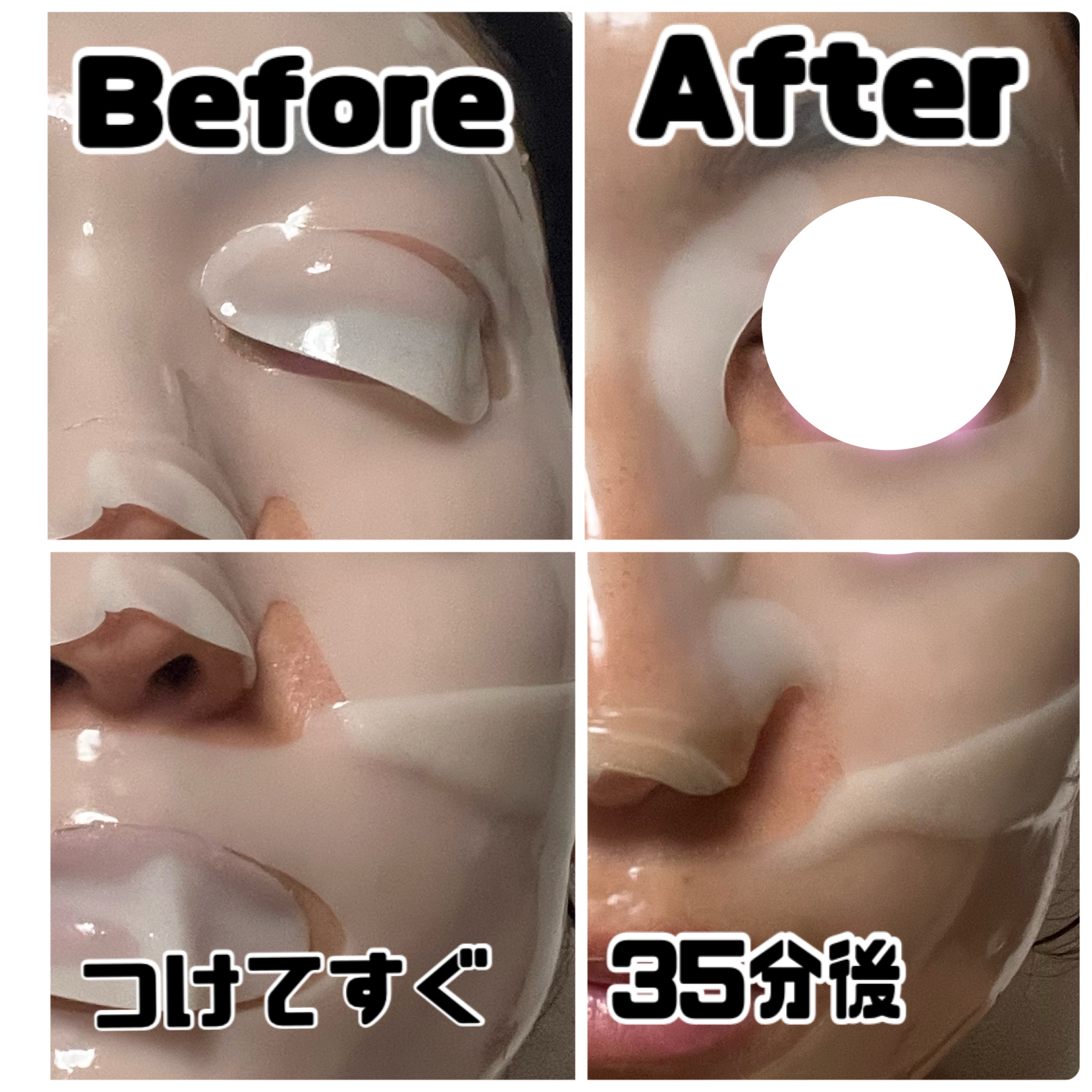 ビタライト リードルショット100 2ステップハイドロゲルマスク/VT/シートマスク・パックを使ったクチコミ（2枚目）