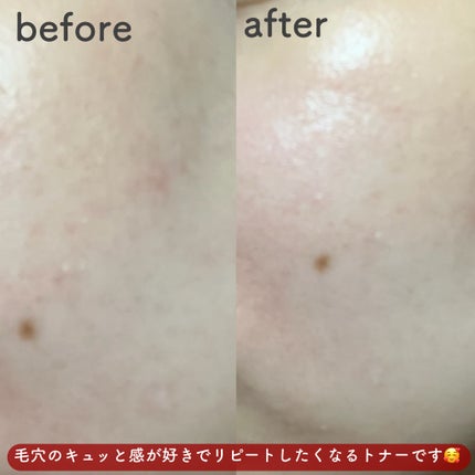 ポアシュータートナー/リターニュ/化粧水を使ったクチコミ(5枚目)