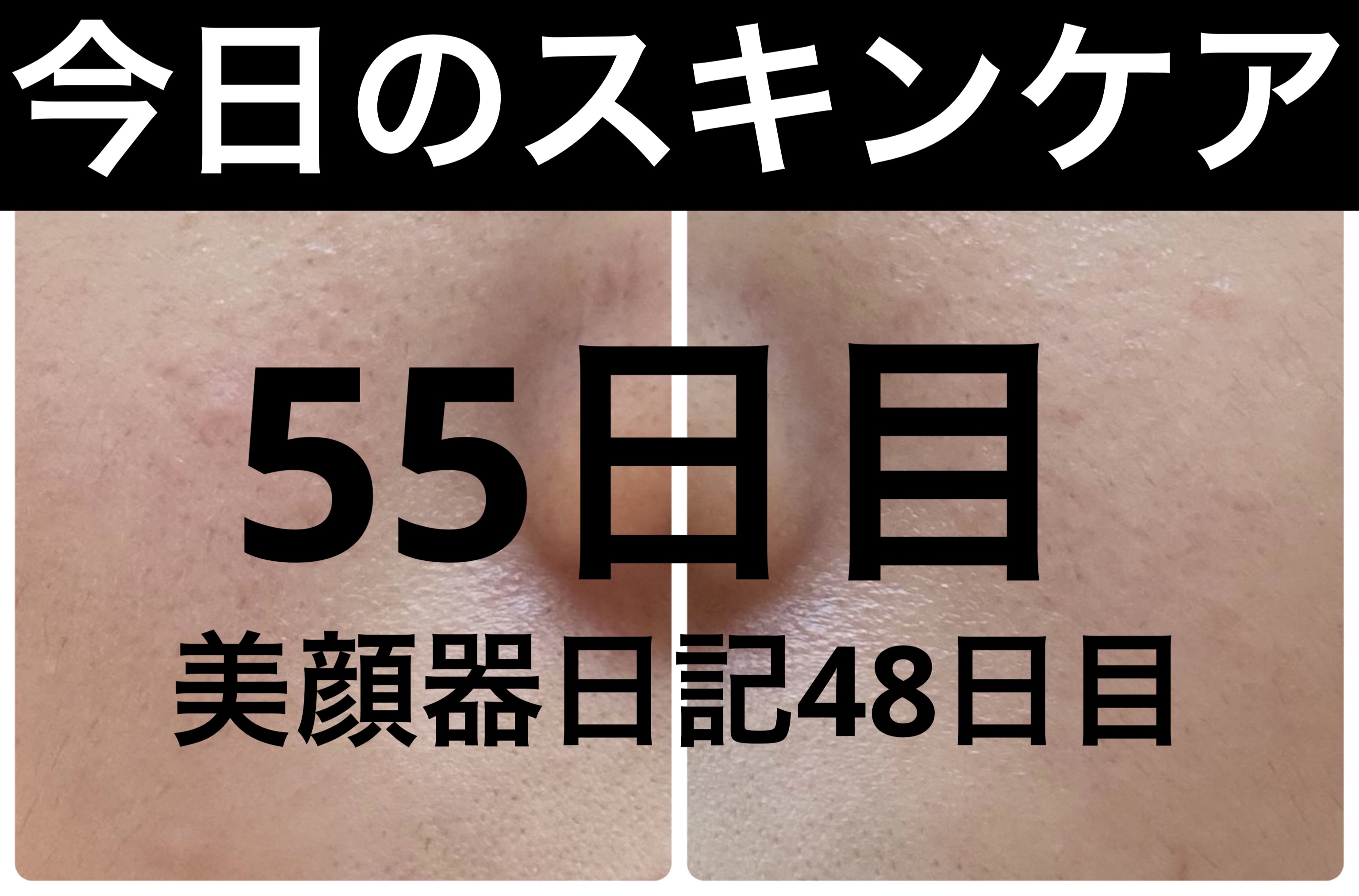 GLAM UP炭酸泡クレイマスク/GLAM UP/洗い流すパック・マスクを使ったクチコミ（1枚目）