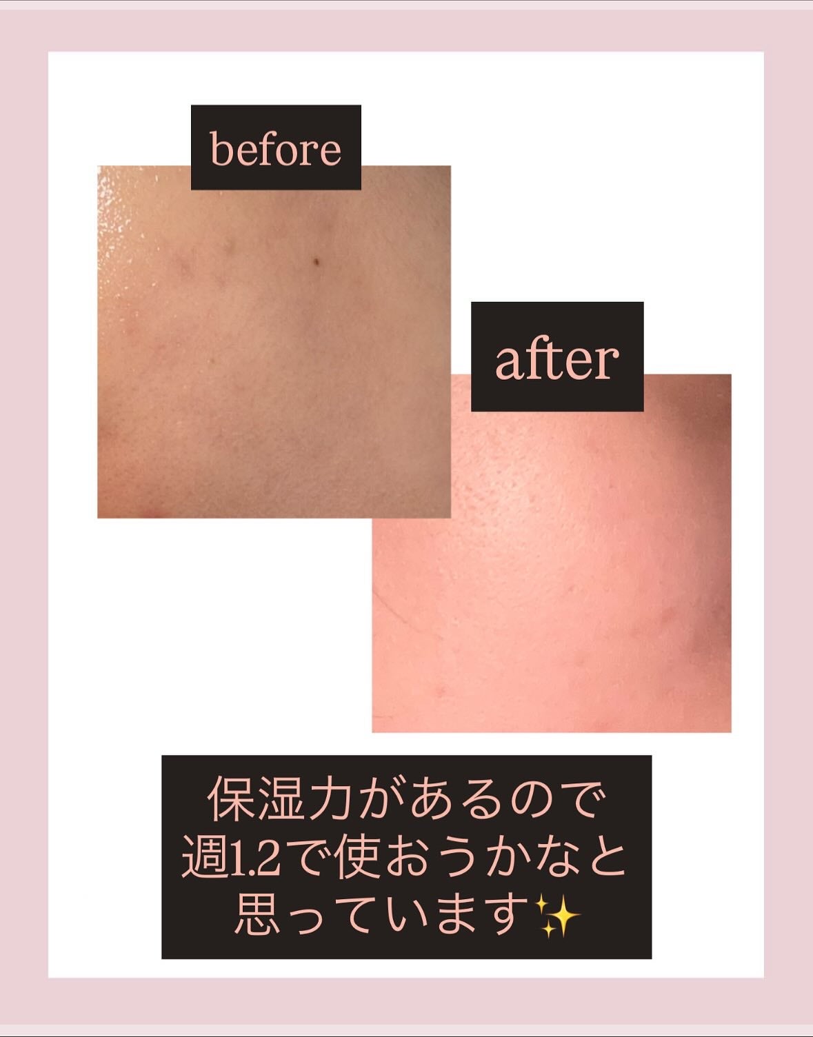 プレミアムもちソープ「グリーンアルティザン」/アレンシア/その他洗顔料を使ったクチコミ(4枚目)