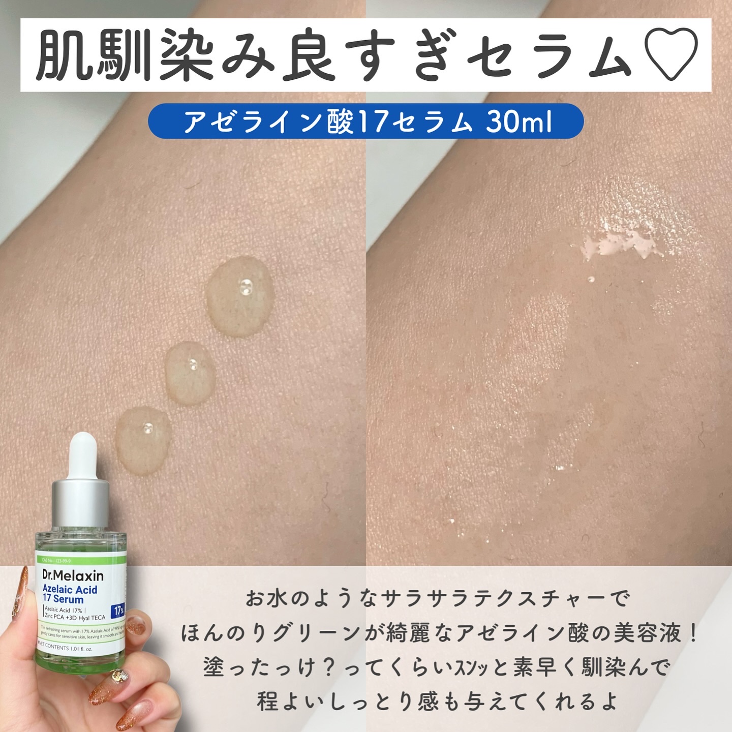 アゼライン酸ゴマージュピーリングセラム/Dr.Melaxin/美容液を使ったクチコミ（2枚目）