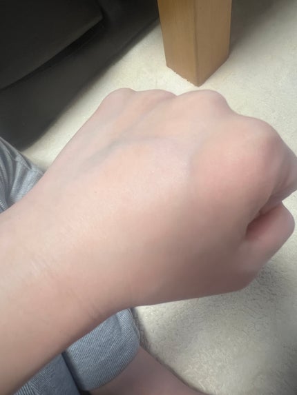 PDRNキューブセラム/DPPR/美容液を使ったクチコミ(4枚目)