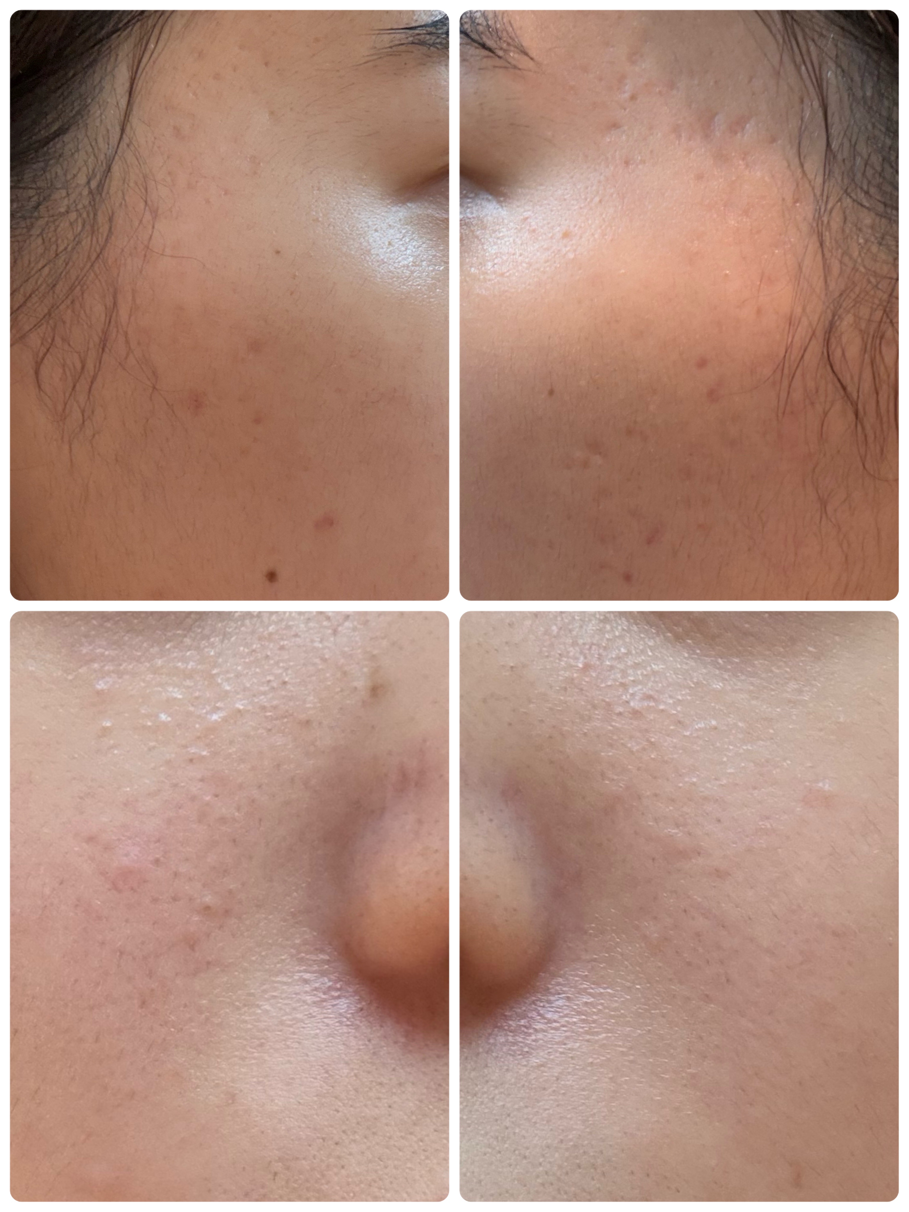 GLAM UP炭酸泡クレイマスク/GLAM UP/洗い流すパック・マスクを使ったクチコミ（2枚目）