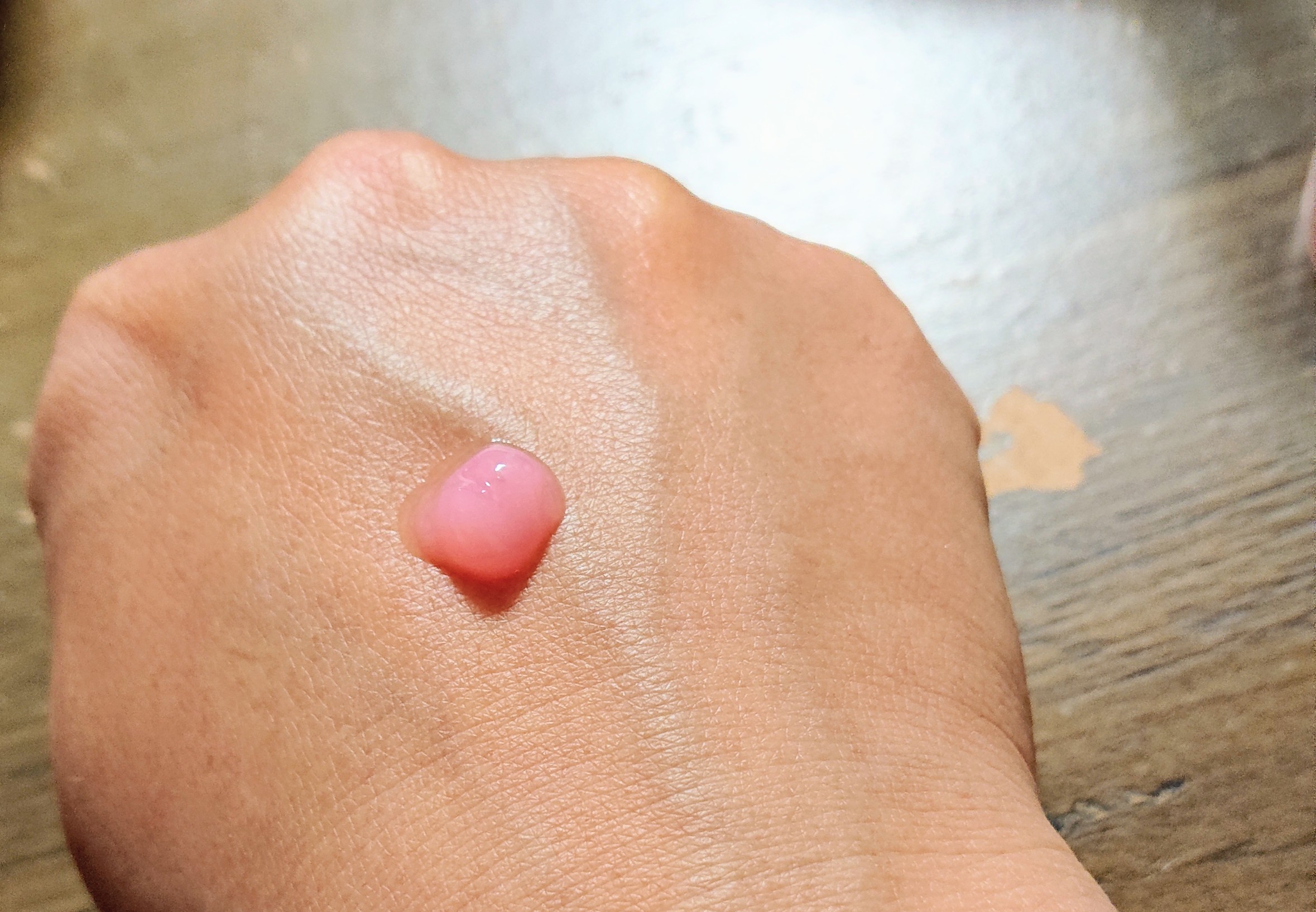 PDRNキューブセラム/DPPR/美容液を使ったクチコミ（1枚目）