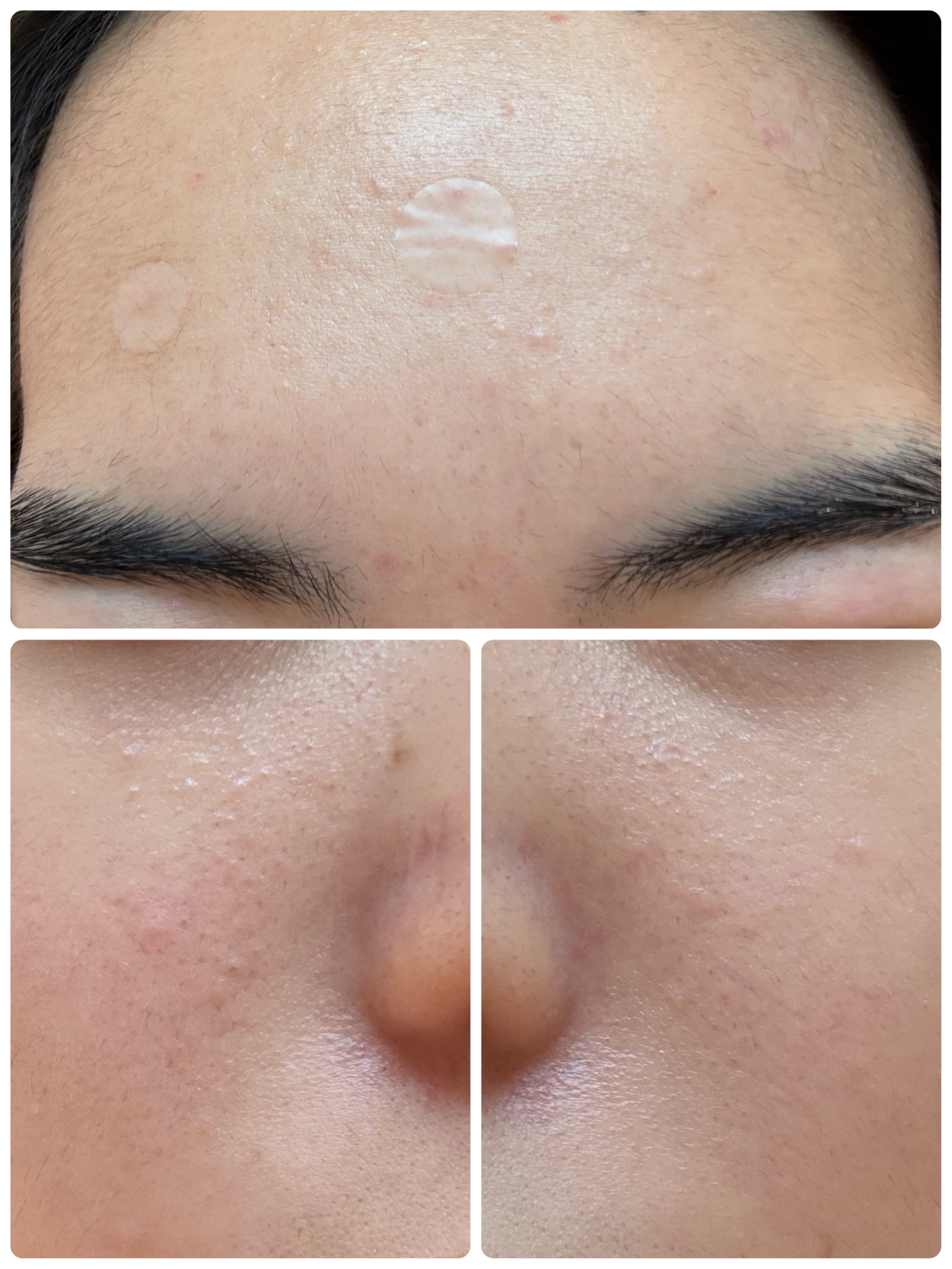 GLAM UP炭酸泡クレイマスク/GLAM UP/洗い流すパック・マスクを使ったクチコミ（3枚目）