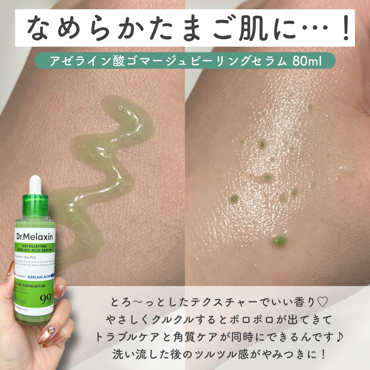 アゼライン酸ゴマージュピーリングセラム/Dr.Melaxin/美容液を使ったクチコミ（3枚目）