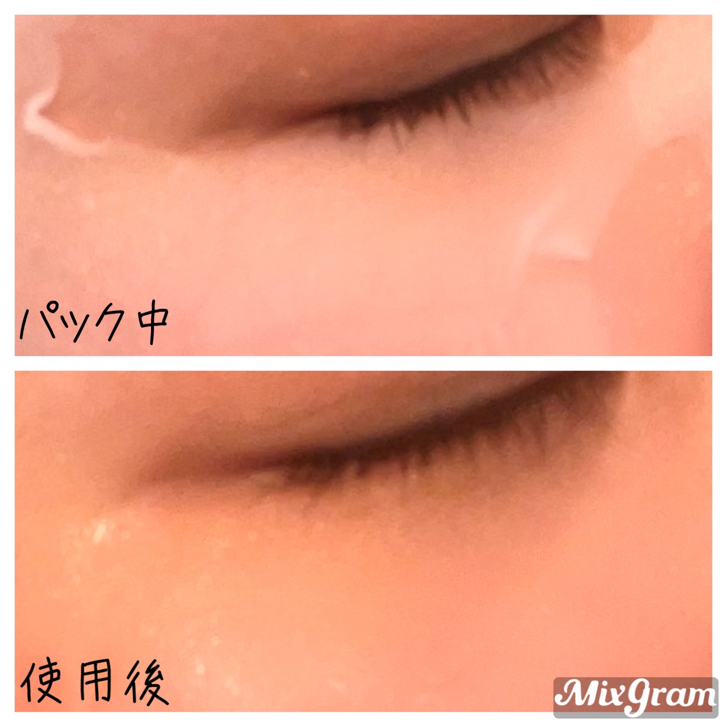 SNP リアルアクティブハイドレーションアンプルマスクのクチコミ「SNP
▶︎リアルアクティブハイドレーションアンプルマスク


\つるつる潤いケア/
美容液丸.....」（2枚目）