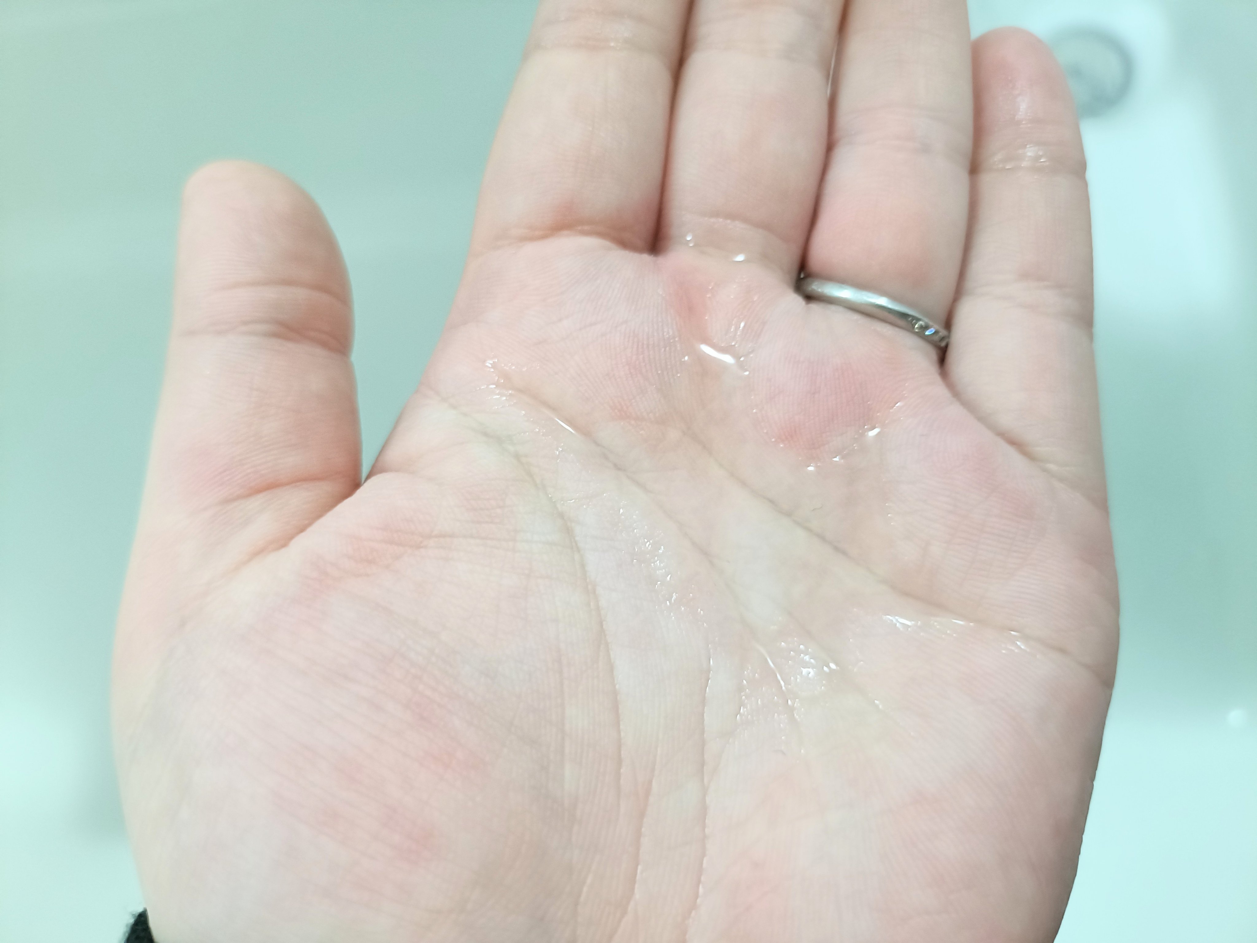 バランシングGAローション/TOUT VERT/化粧水を使ったクチコミ（2枚目）