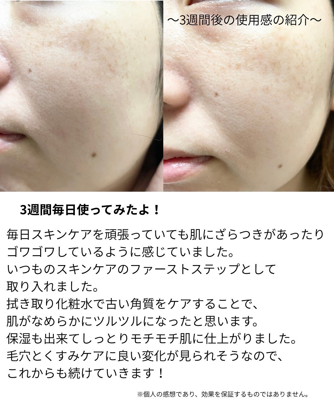 ネイチャーコンク 薬用 クリアローションとてもしっとり/ネイチャーコンク/拭き取り化粧水を使ったクチコミ(3枚目)