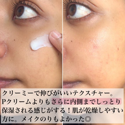 バデカシルDクリーム/23years old/フェイスクリームを使ったクチコミ(7枚目)